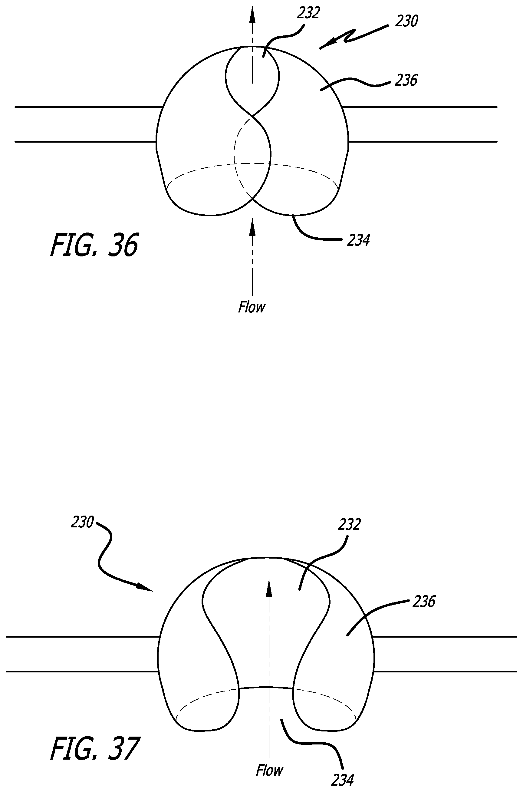 Patent US12376978 Figure 10 – Methods and technology for creating connections and shunts between vessels and chambers of biologic structures