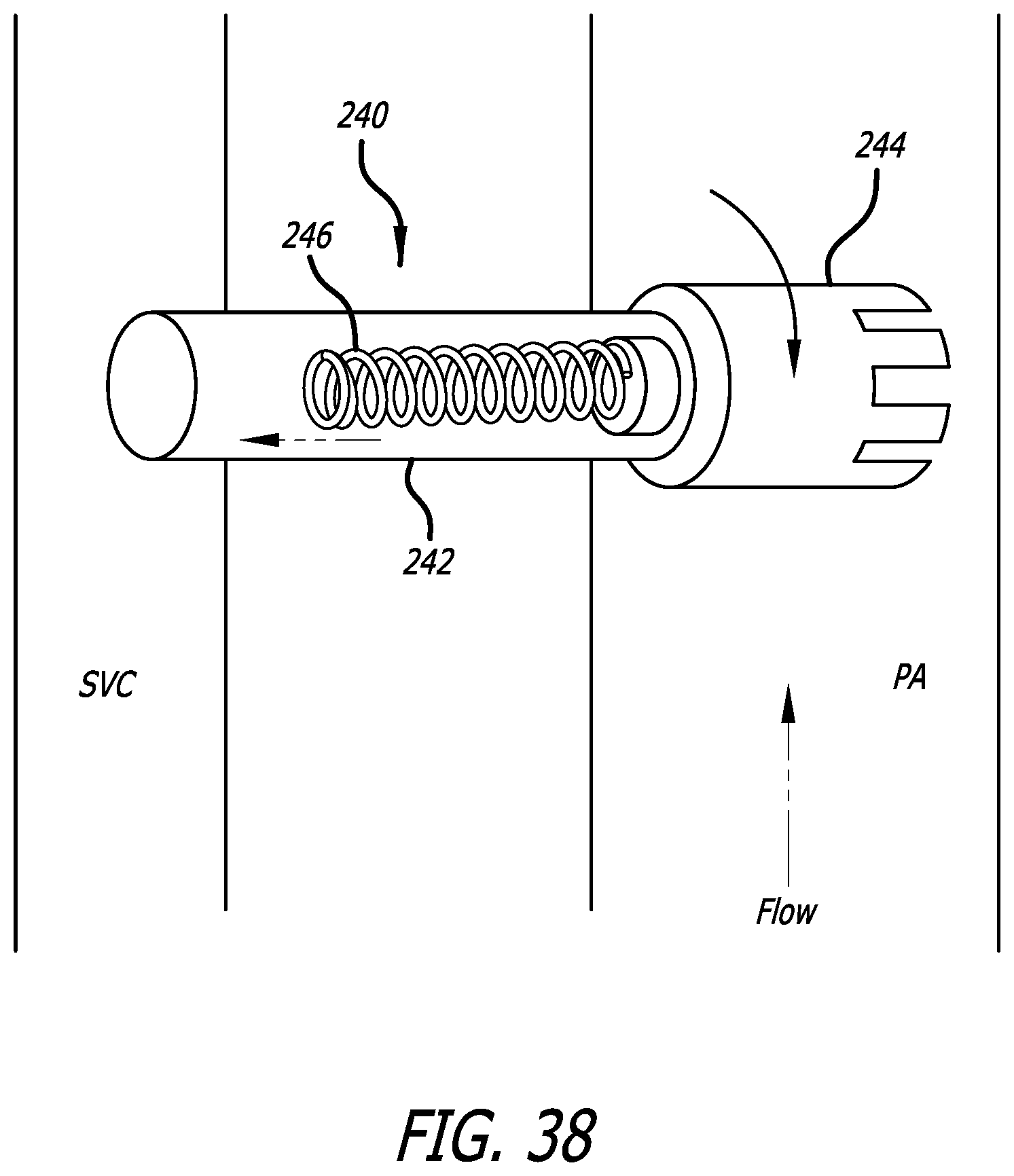 Patent US12376978 Figure 11 – Methods and technology for creating connections and shunts between vessels and chambers of biologic structures