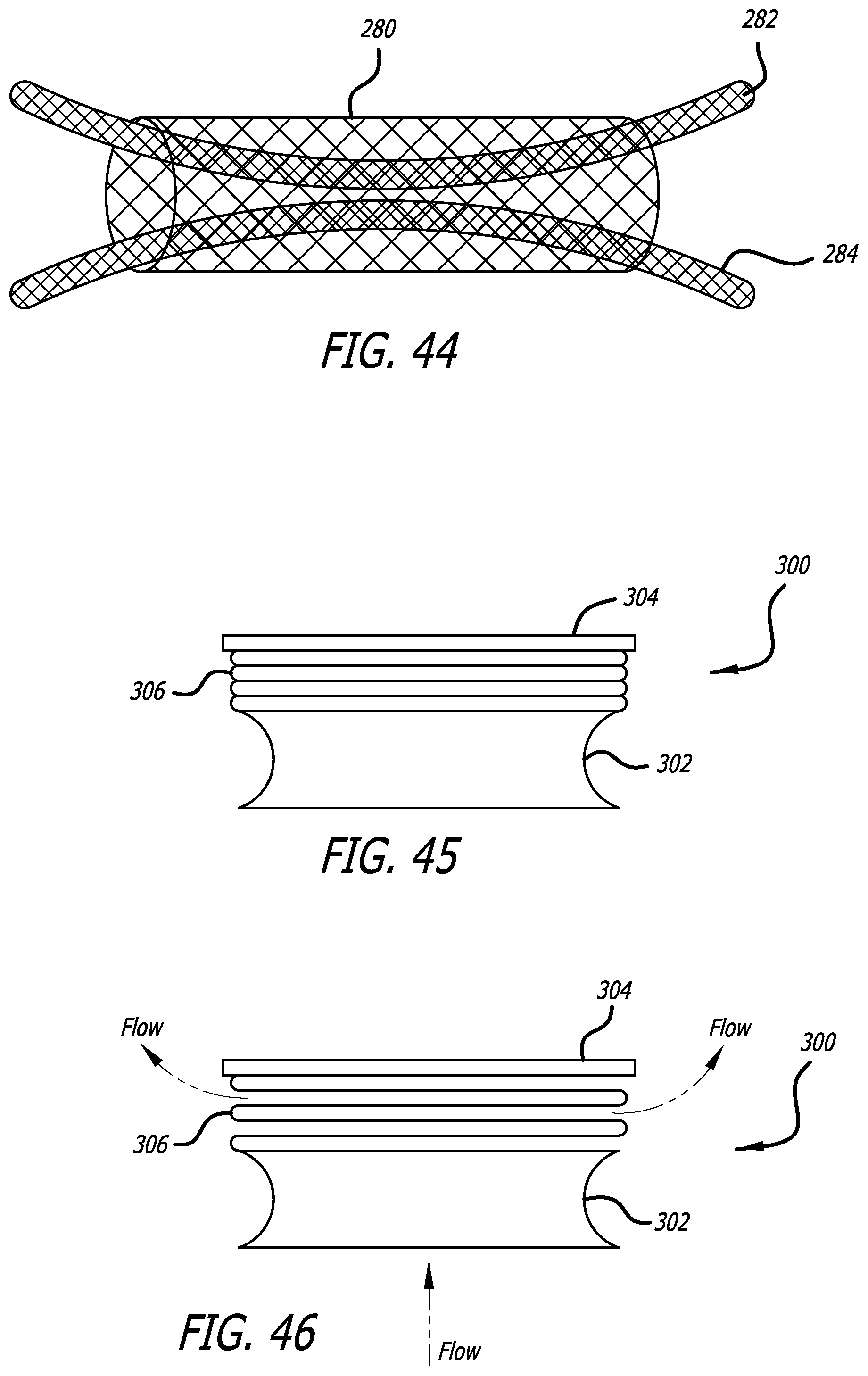 Patent US12376978 Figure 14 – Methods and technology for creating connections and shunts between vessels and chambers of biologic structures