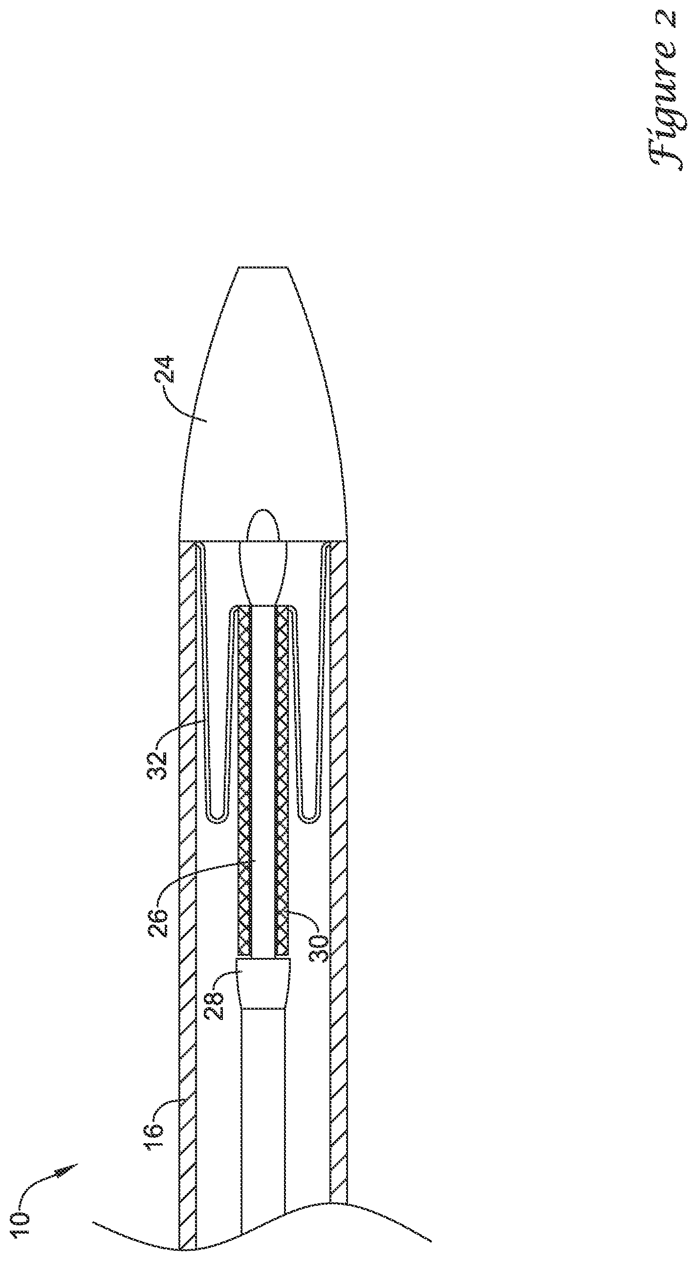 Patent US12376980 Figure 2 – Stent delivery systems with a reconstraining member