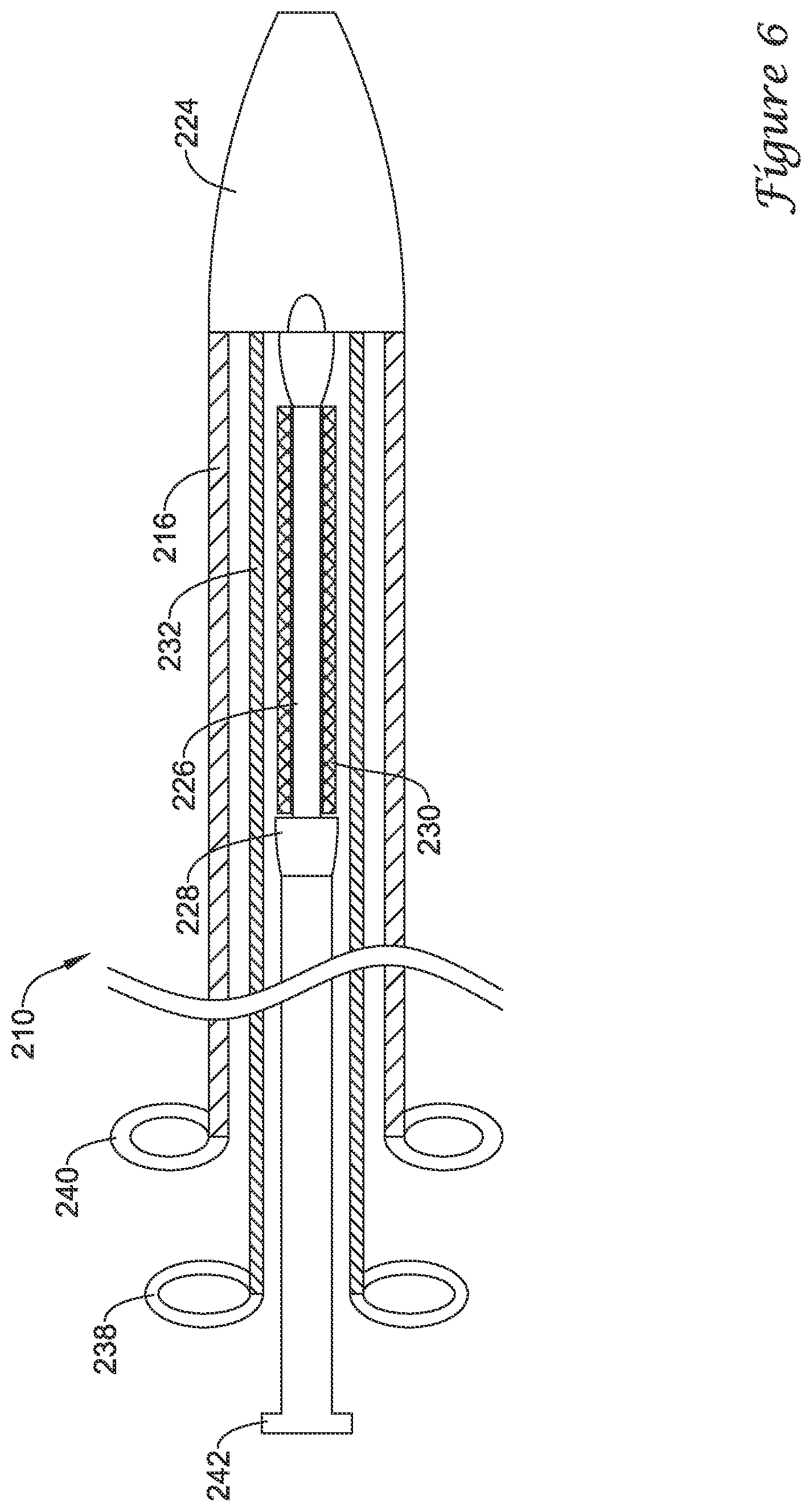 Patent US12376980 Figure 6 – Stent delivery systems with a reconstraining member