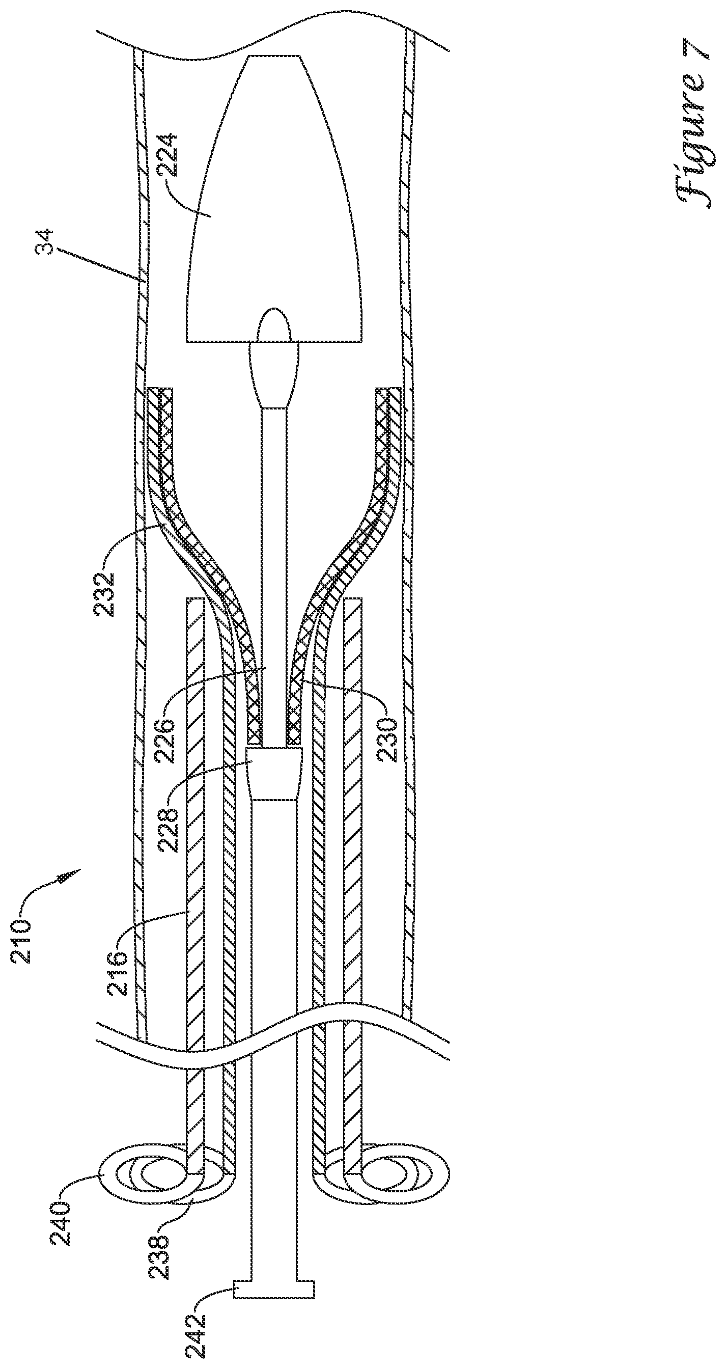 Patent US12376980 Figure 7 – Stent delivery systems with a reconstraining member