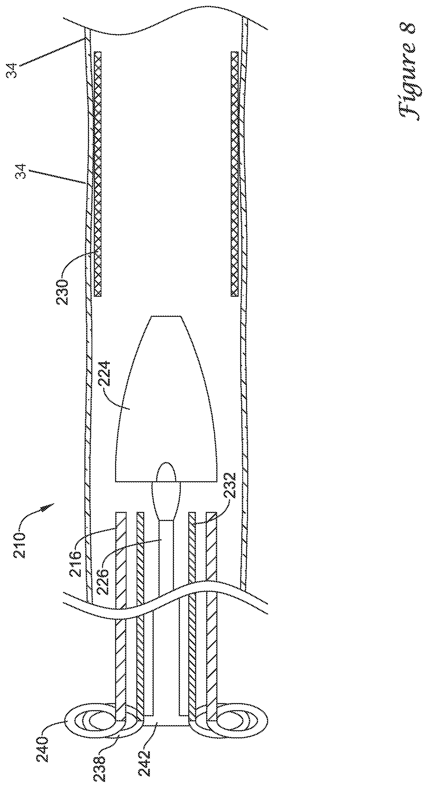 Patent US12376980 Figure 8 – Stent delivery systems with a reconstraining member