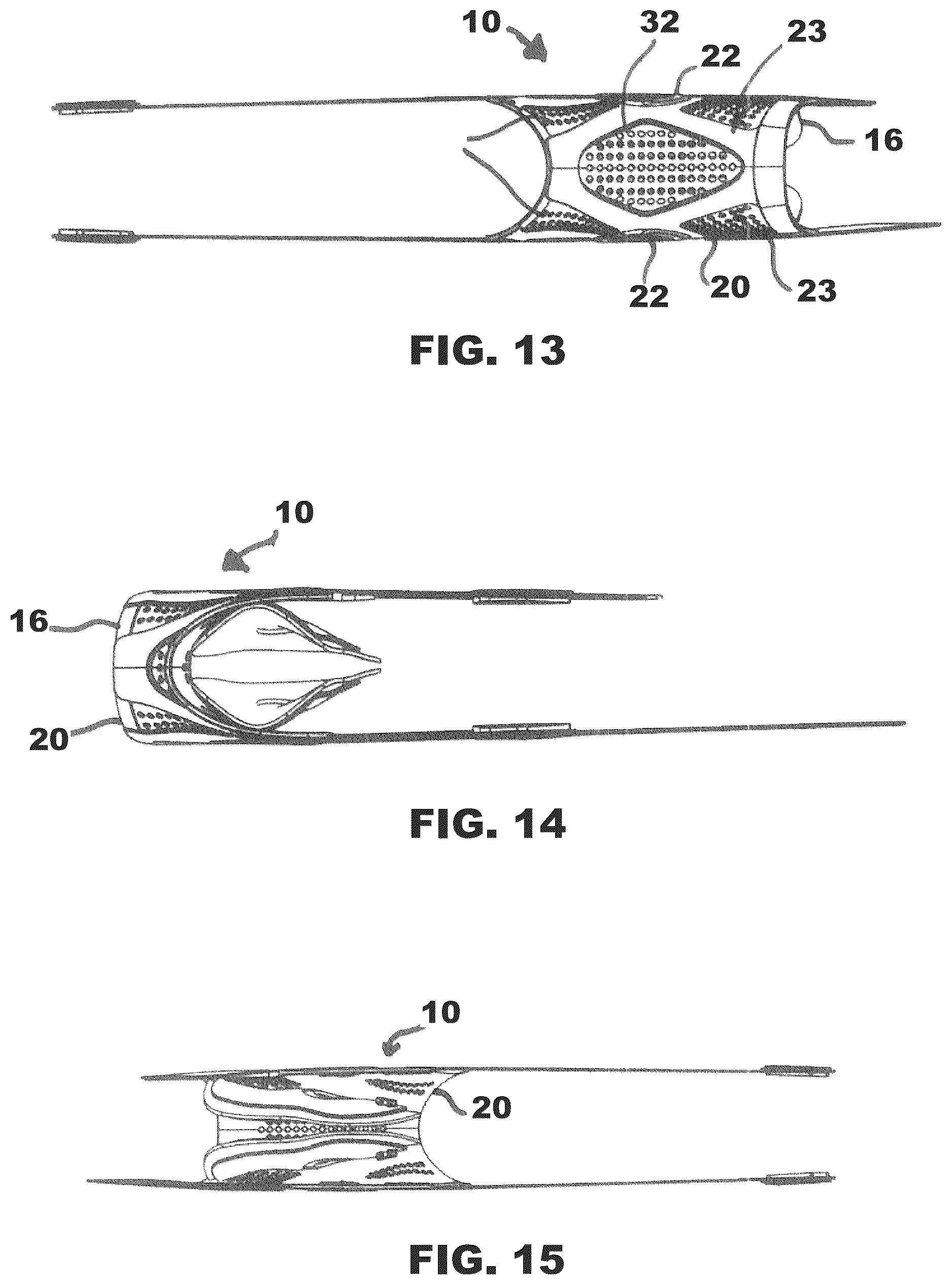 Patent US12376981 Figure 3 – Universal dynamic athletic ankle brace and add-on interior stirrup support system