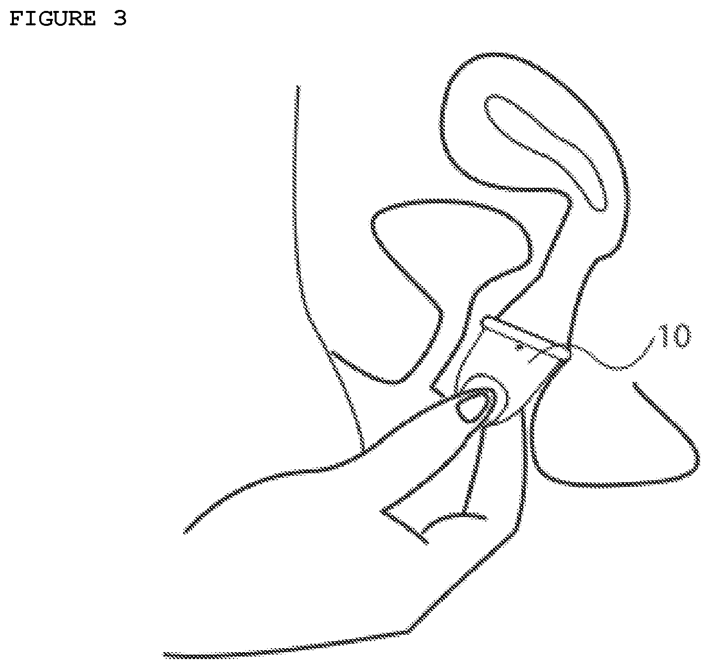 Patent US12376986 Figure 3 – Anatomical menstrual cup