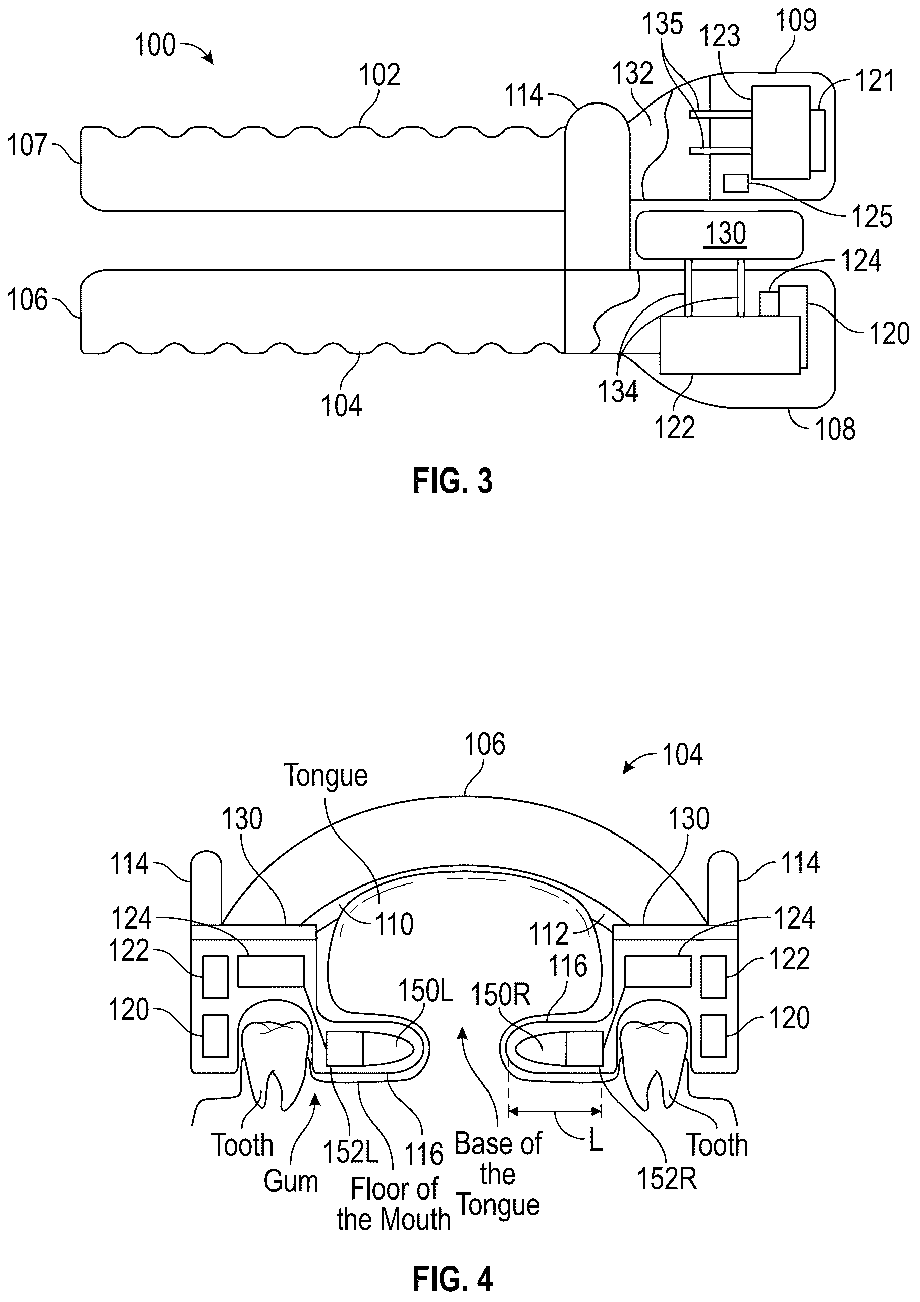 Patent US12376987 Figure 2 – Dynamic mandibular and lingual repositioning devices, controller station, and methods of treating and/or diagnosing medical disorders