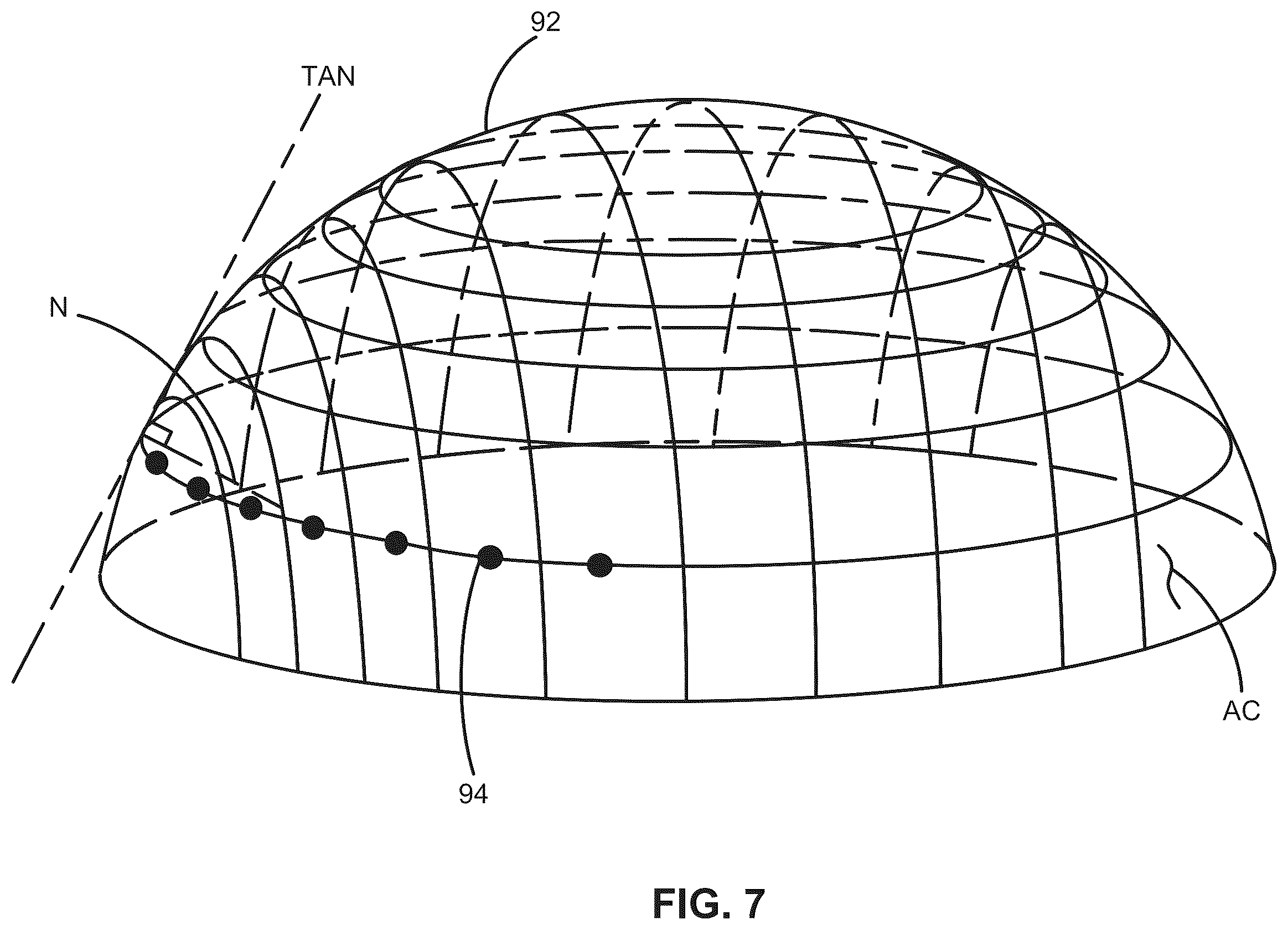 Patent US12376988 Figure 10 – Apparatus for delivering ocular implants into an anterior chamber of the eye