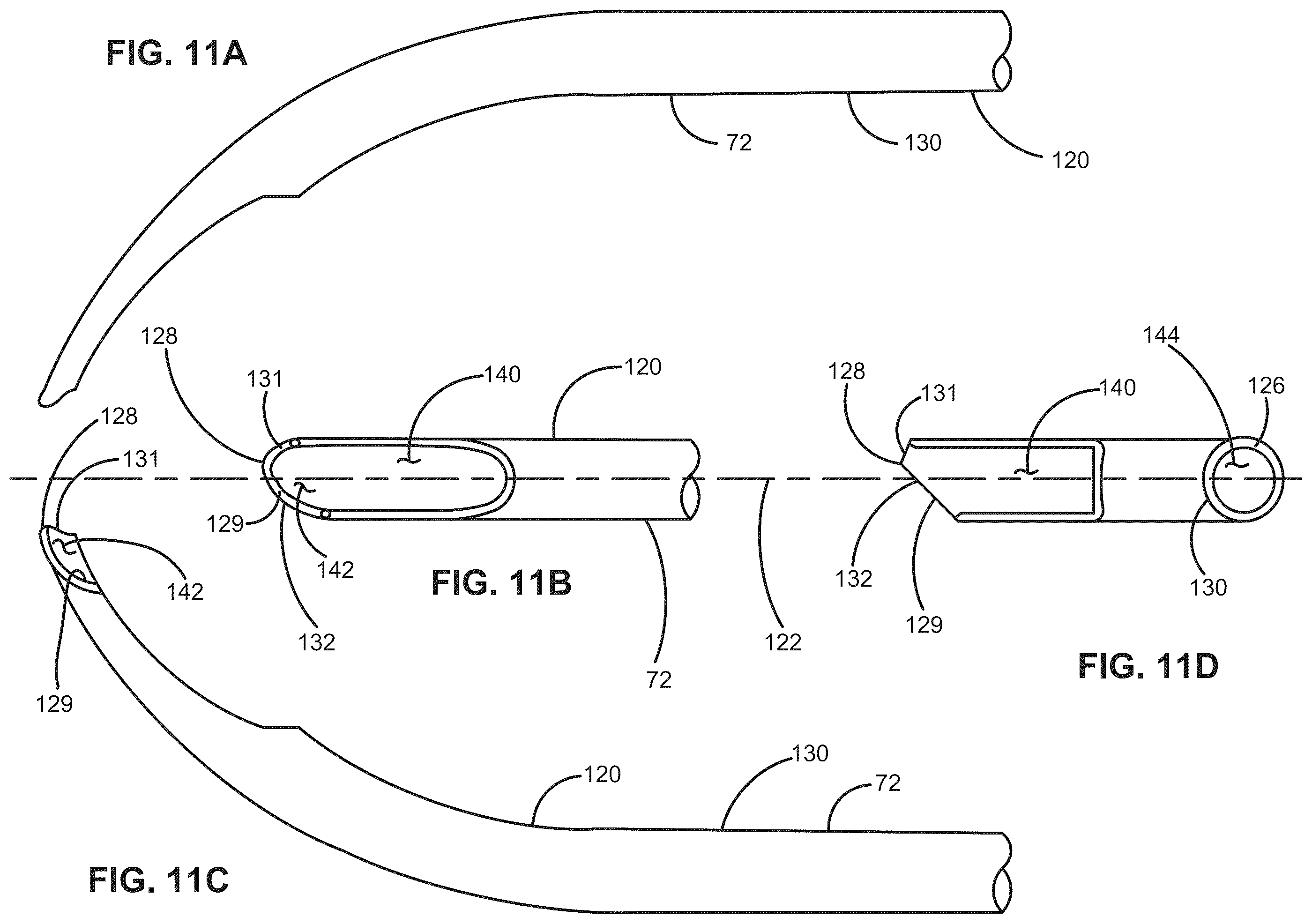 Patent US12376988 Figure 14 – Apparatus for delivering ocular implants into an anterior chamber of the eye