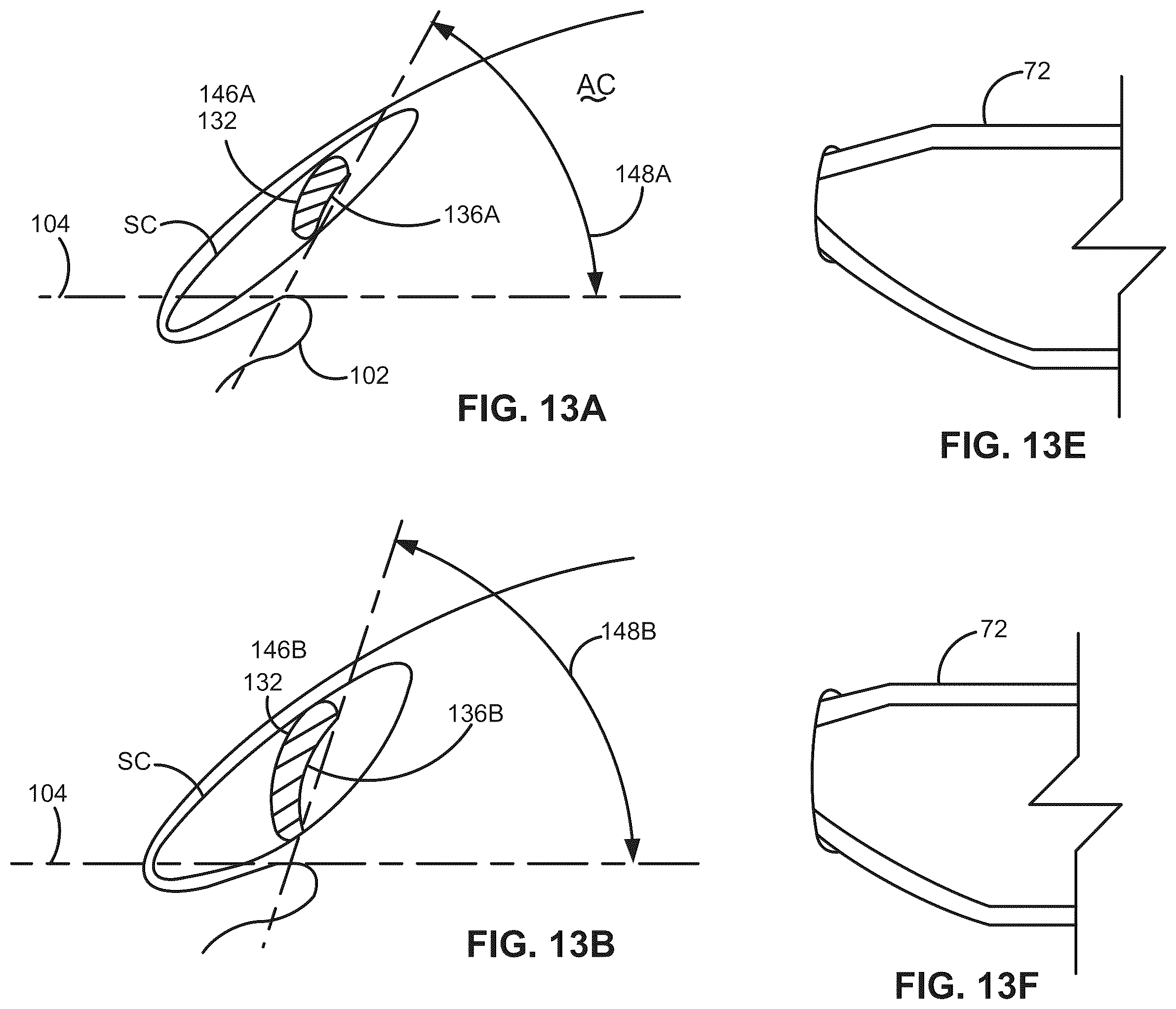 Patent US12376988 Figure 16 – Apparatus for delivering ocular implants into an anterior chamber of the eye