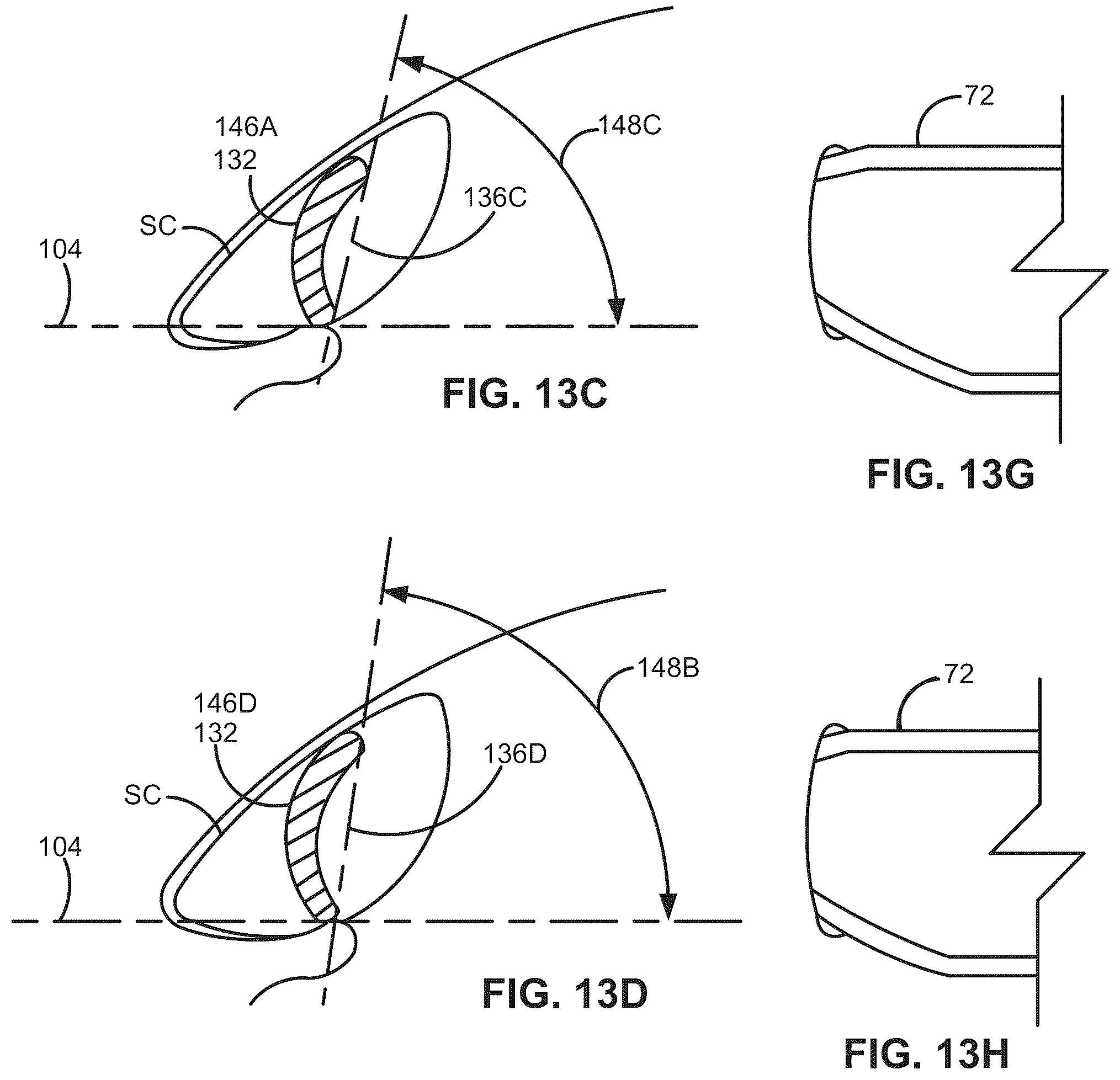 Patent US12376988 Figure 17 – Apparatus for delivering ocular implants into an anterior chamber of the eye
