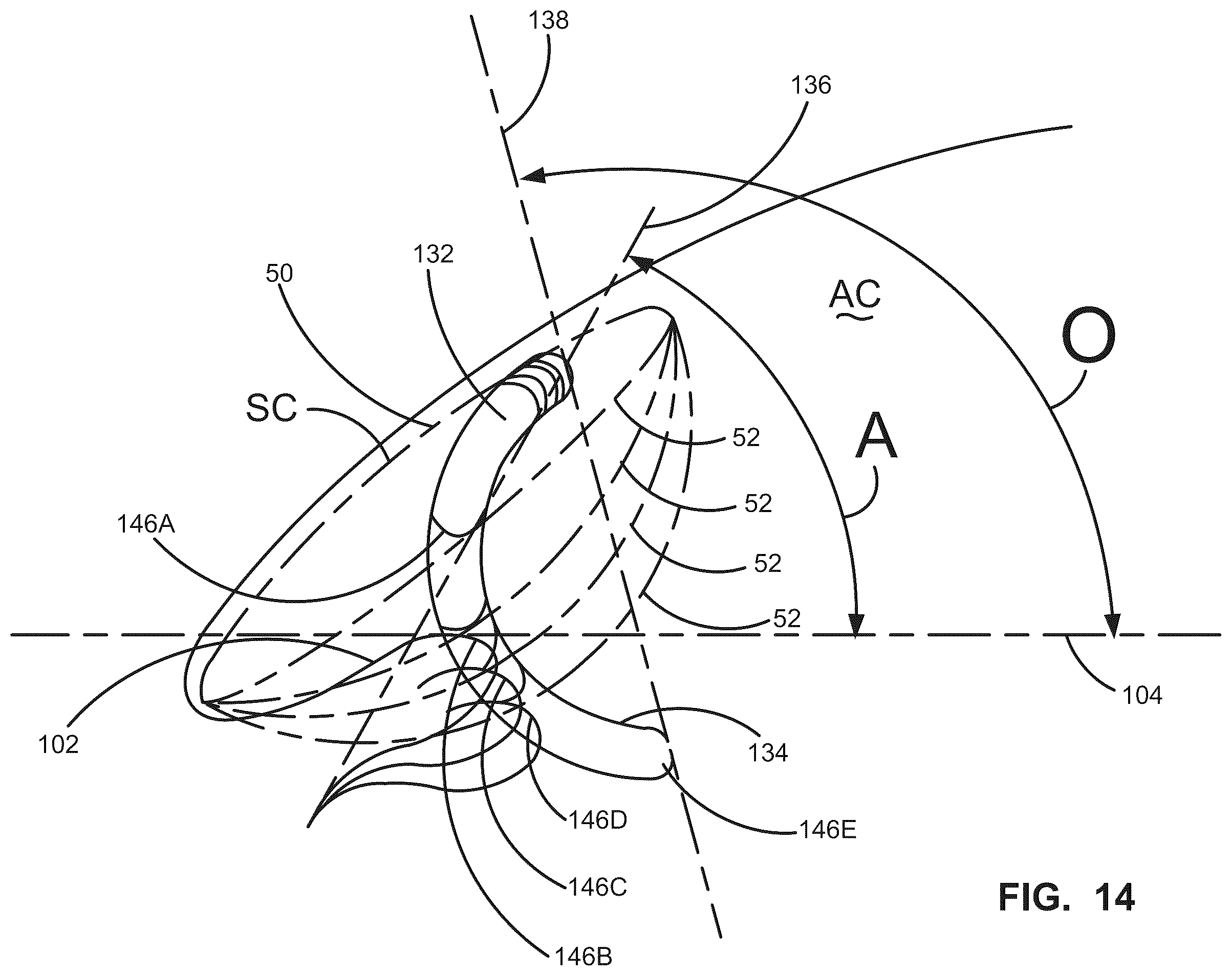 Patent US12376988 Figure 18 – Apparatus for delivering ocular implants into an anterior chamber of the eye