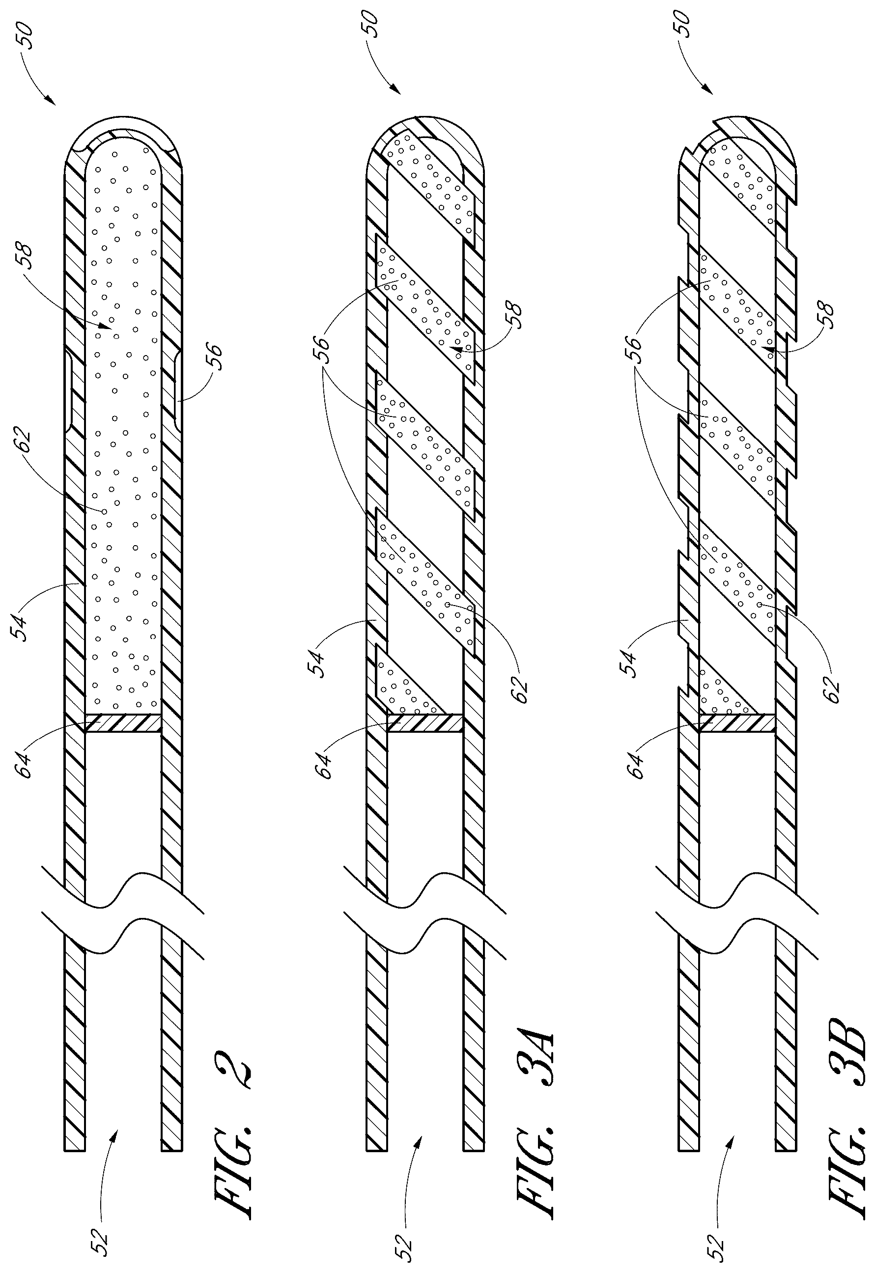 Patent US12376989 Figure 2 – Drug eluting ocular implants and methods of treating an ocular disorder