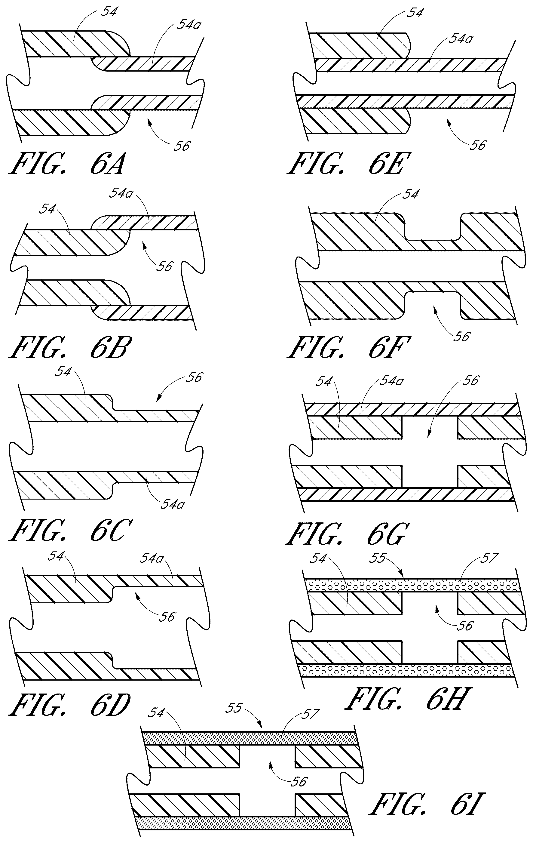 Patent US12376989 Figure 4 – Drug eluting ocular implants and methods of treating an ocular disorder