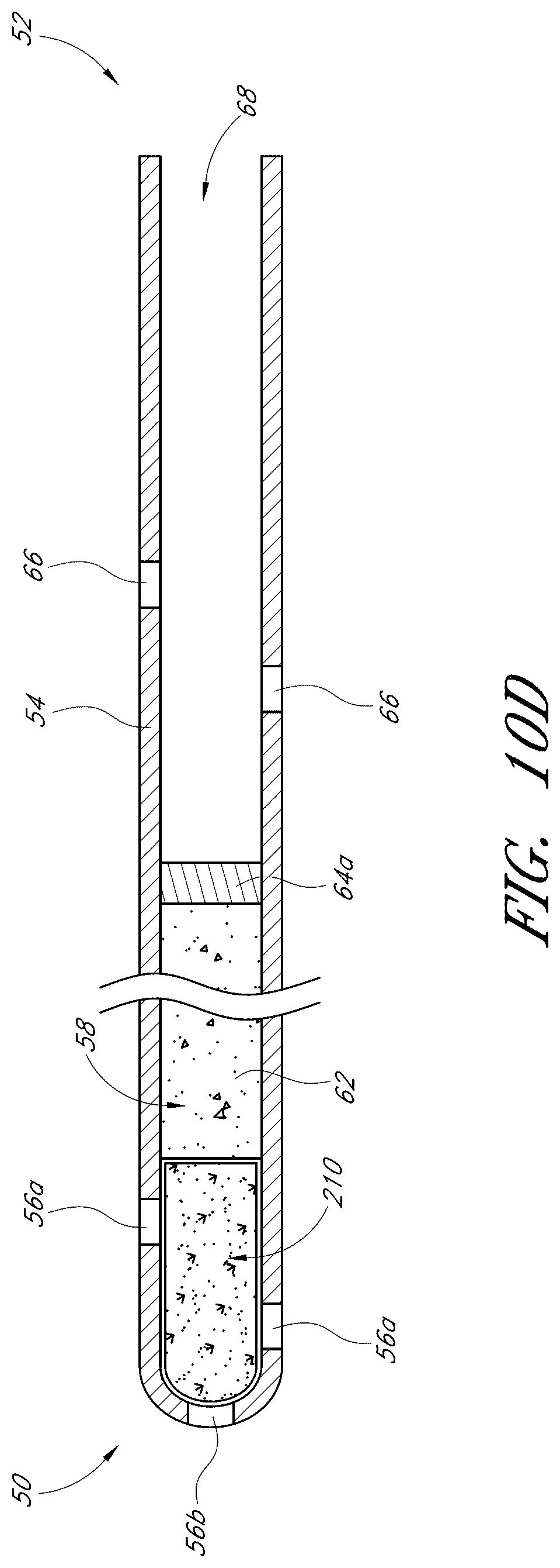 Patent US12376989 Figure 9 – Drug eluting ocular implants and methods of treating an ocular disorder