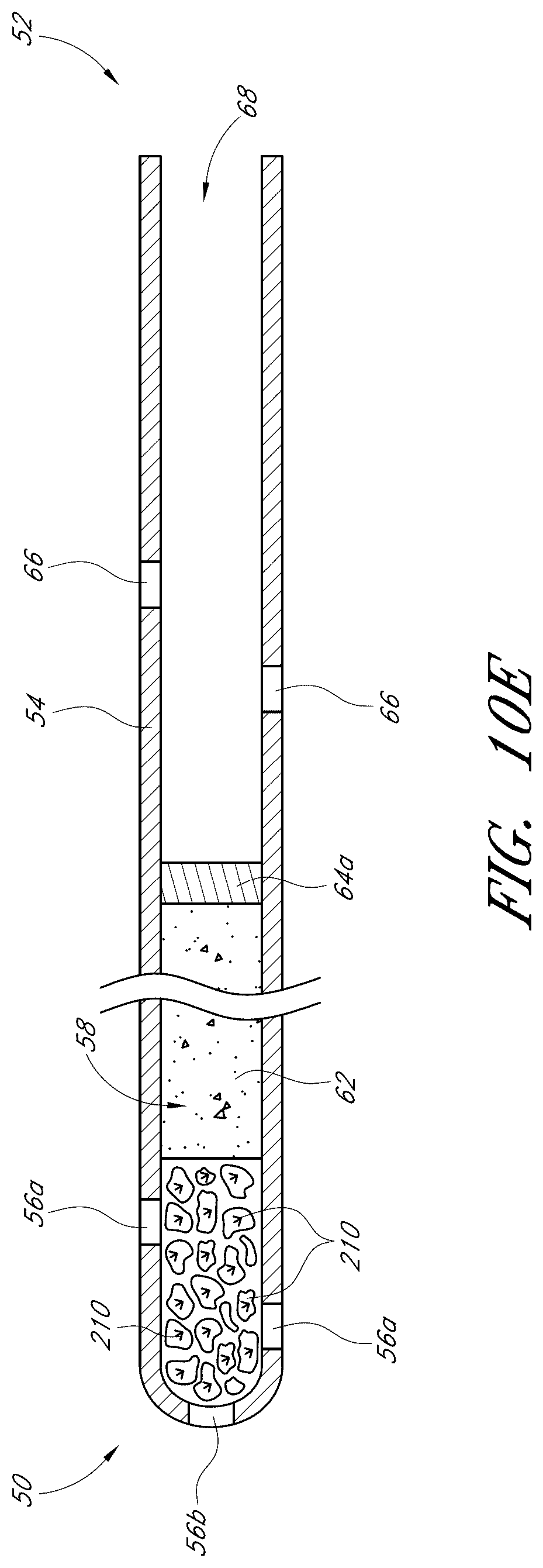 Patent US12376989 Figure 10 – Drug eluting ocular implants and methods of treating an ocular disorder