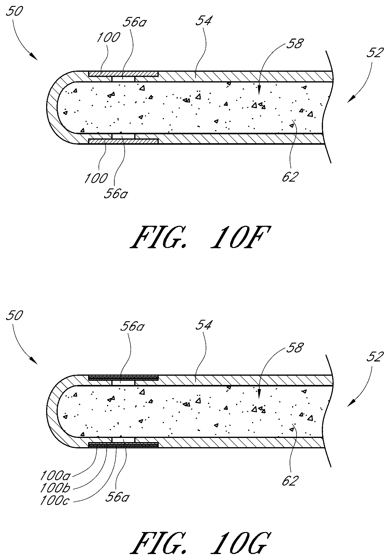 Patent US12376989 Figure 11 – Drug eluting ocular implants and methods of treating an ocular disorder