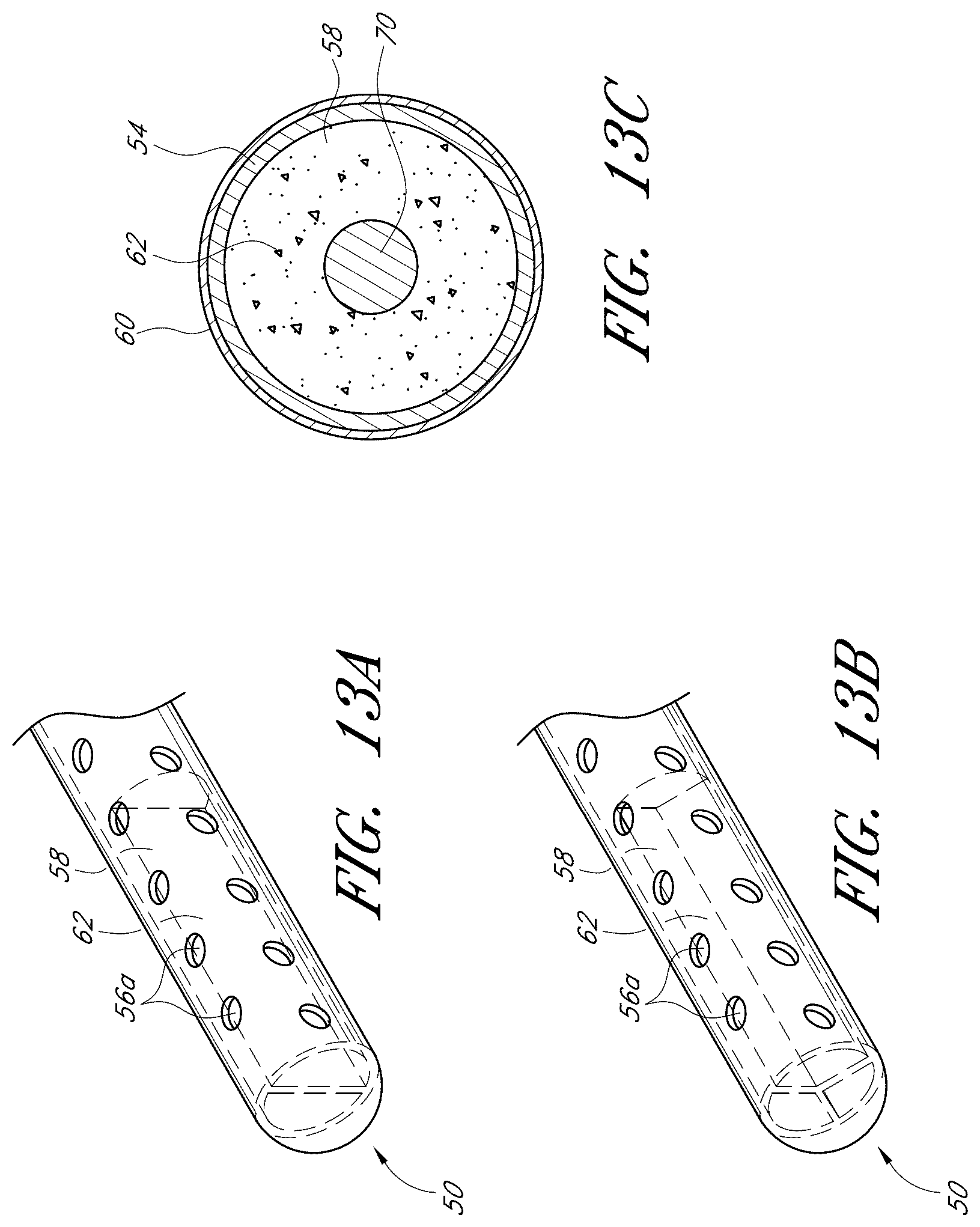 Patent US12376989 Figure 14 – Drug eluting ocular implants and methods of treating an ocular disorder