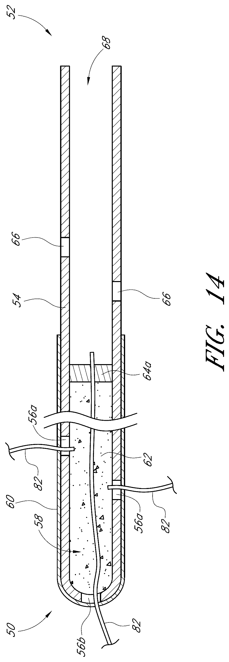 Patent US12376989 Figure 15 – Drug eluting ocular implants and methods of treating an ocular disorder