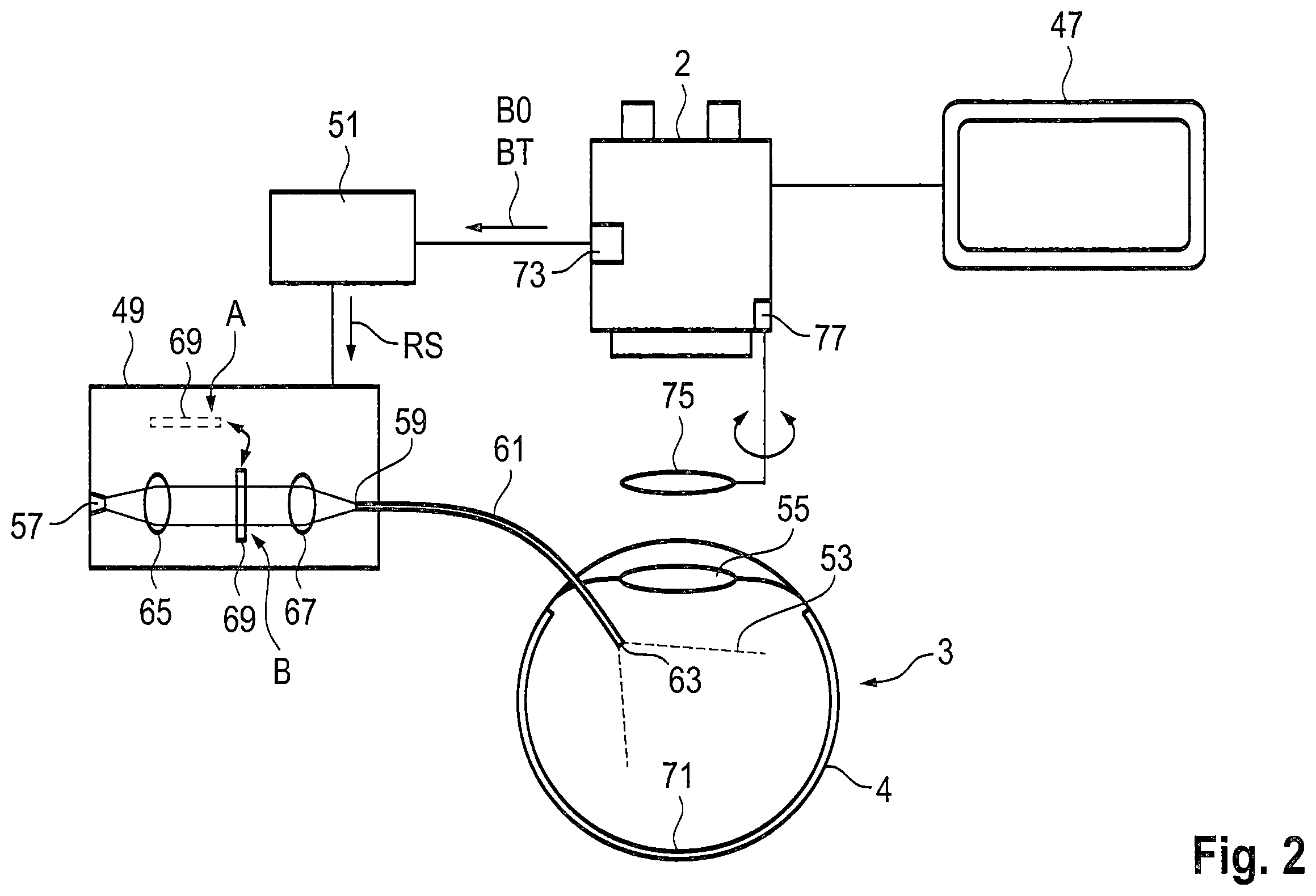 Patent US12376990 Figure 2 – Optical system for eye surgery and method for avoiding an excessive light intensity at a digital image sensor of a surgical microscope