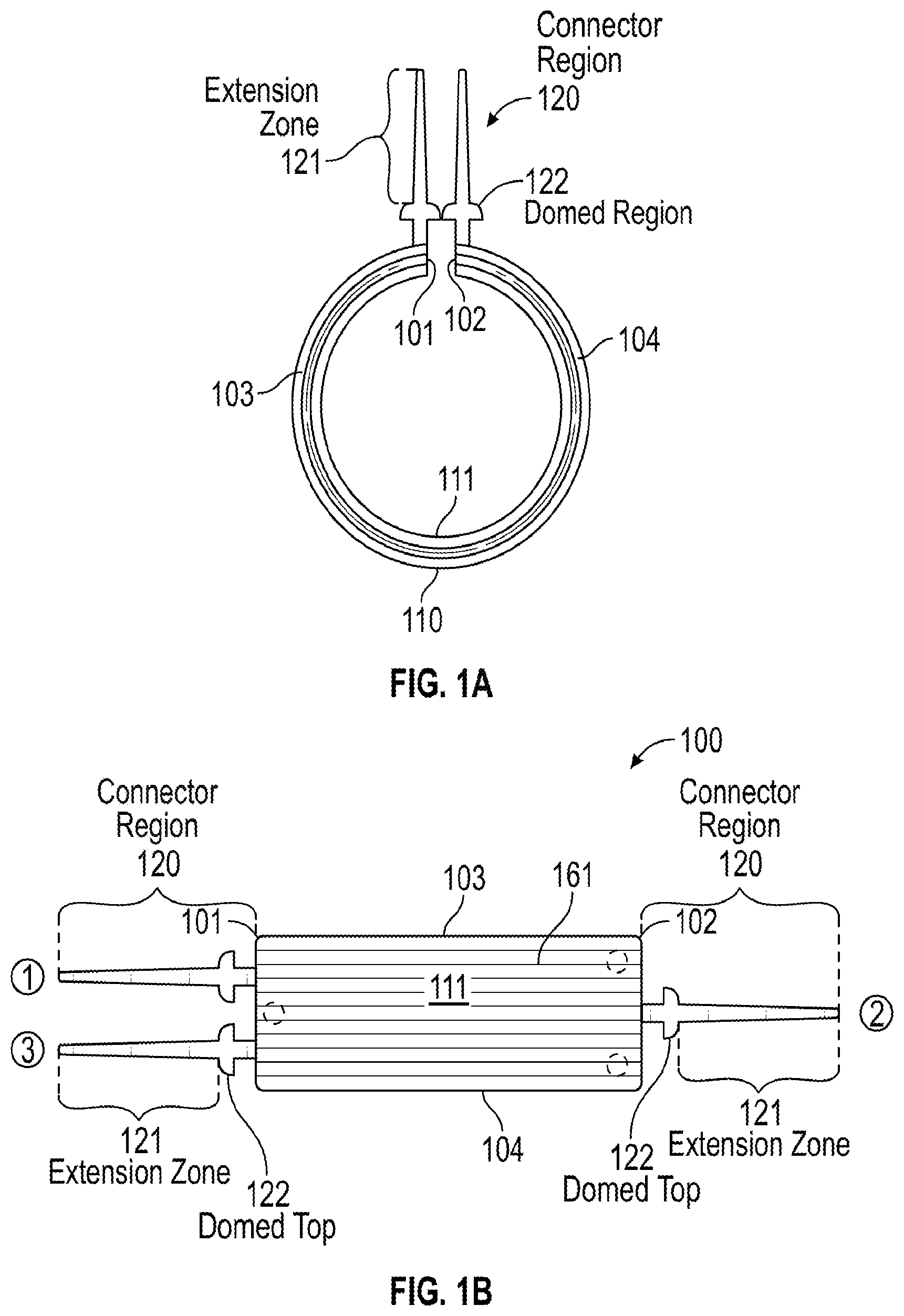 Patent US12376991 Figure 1 – Scleral buckle for alleviation of retinal detachment and refractive error