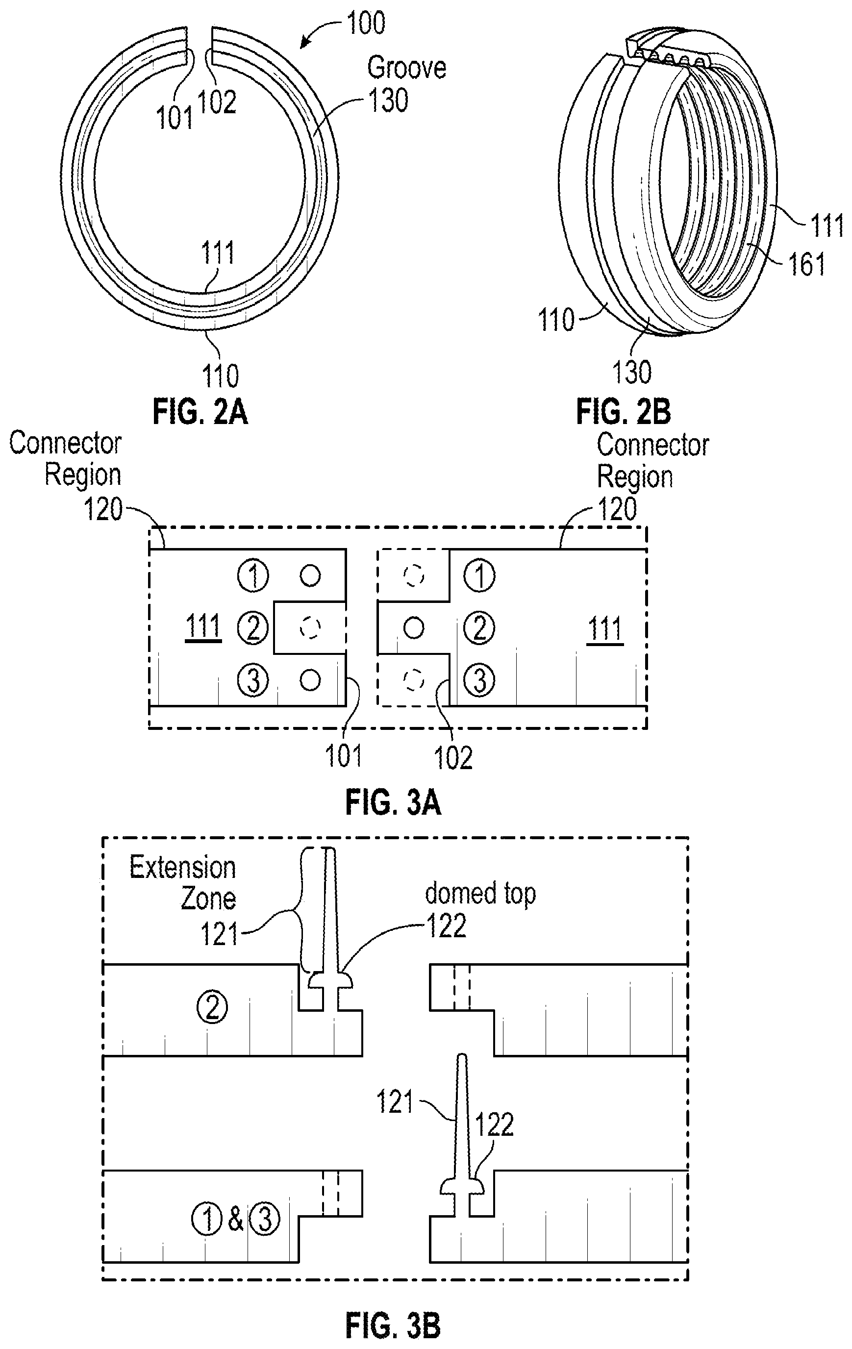 Patent US12376991 Figure 2 – Scleral buckle for alleviation of retinal detachment and refractive error