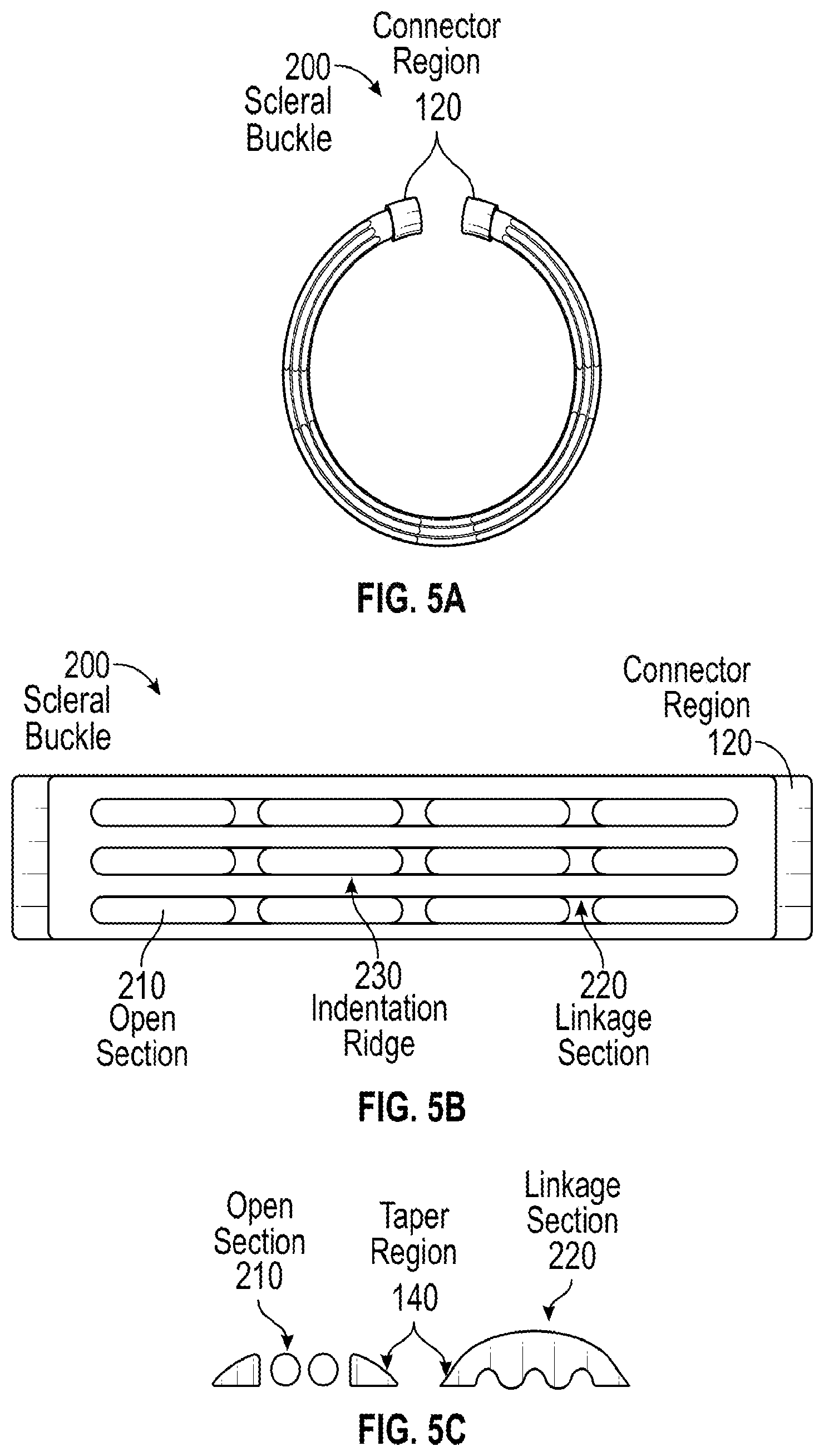 Patent US12376991 Figure 5 – Scleral buckle for alleviation of retinal detachment and refractive error