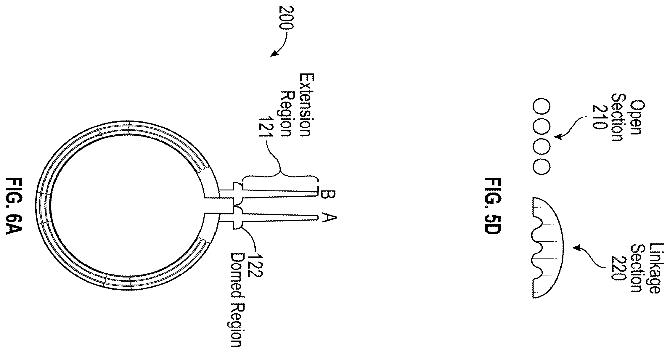 Patent US12376991 Figure 6 – Scleral buckle for alleviation of retinal detachment and refractive error