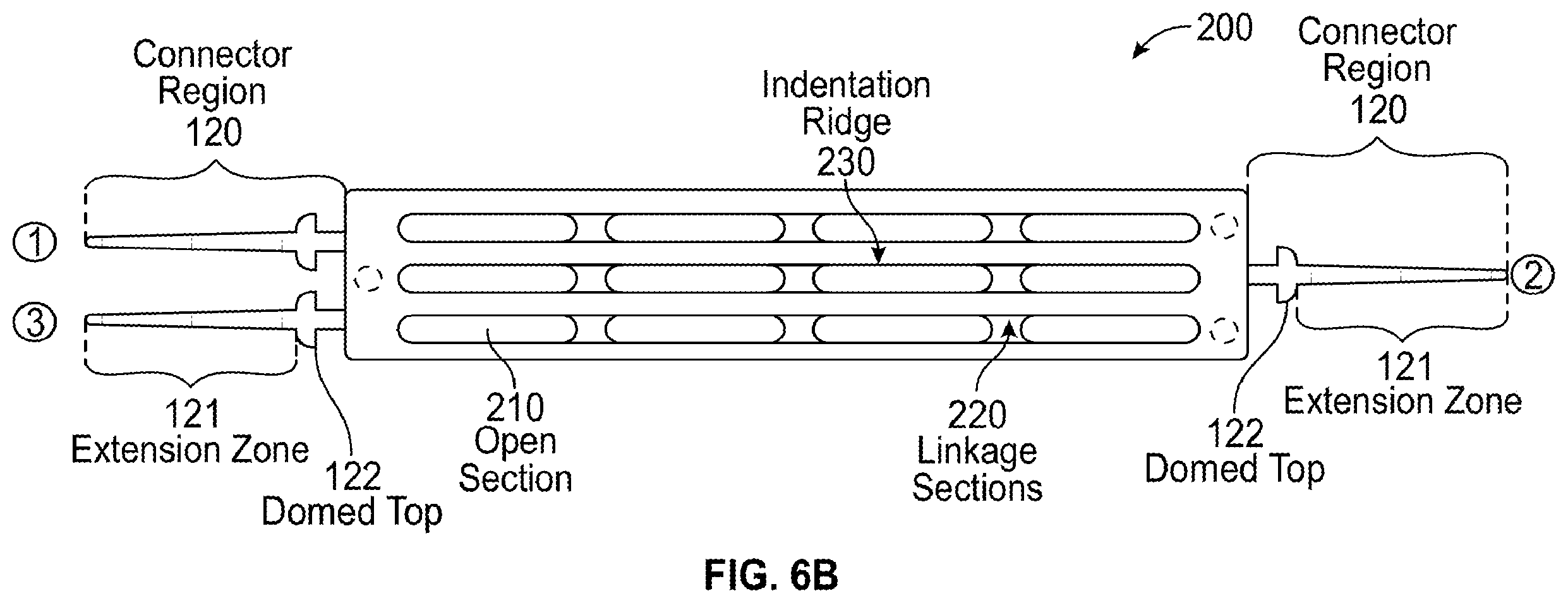Patent US12376991 Figure 7 – Scleral buckle for alleviation of retinal detachment and refractive error