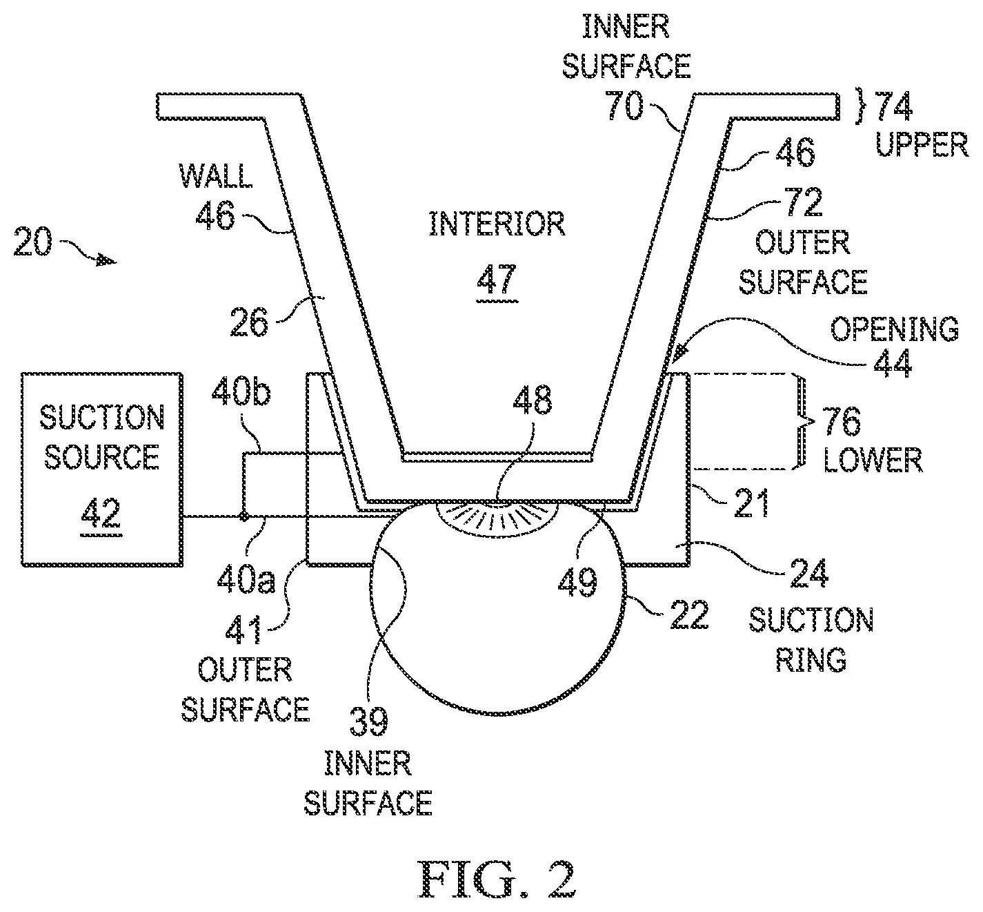 Patent US12376995 Figure 2 – Patient interfaces for cooling eye tissue