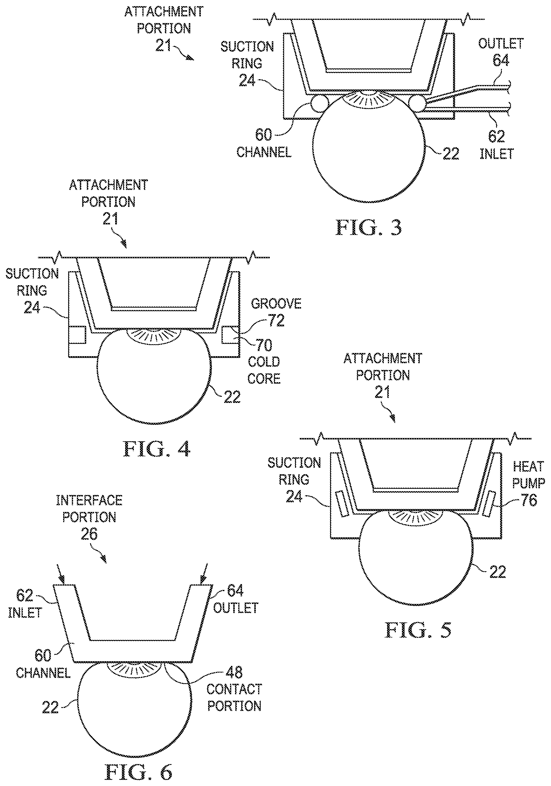 Patent US12376995 Figure 3 – Patient interfaces for cooling eye tissue
