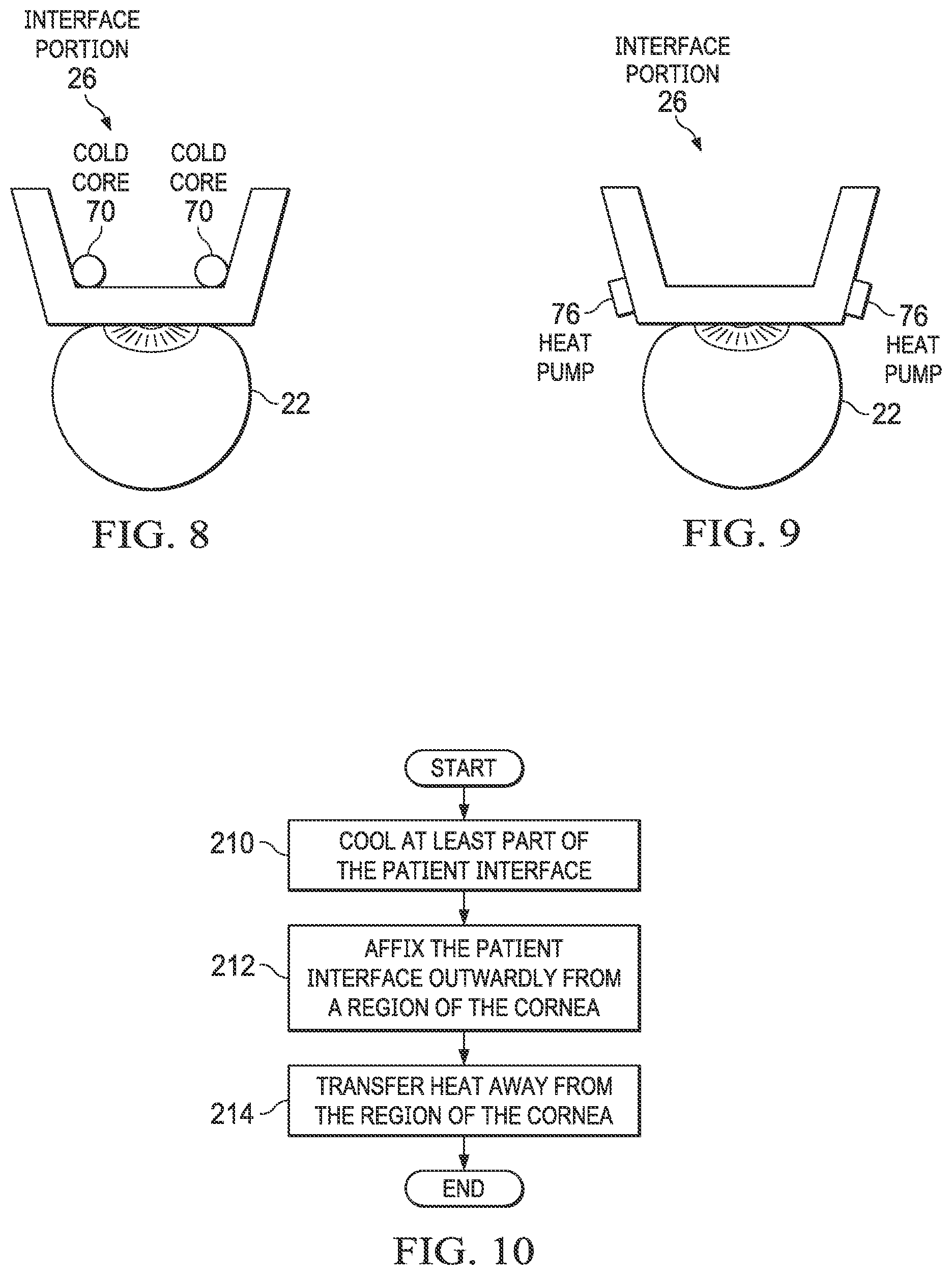 Patent US12376995 Figure 6 – Patient interfaces for cooling eye tissue