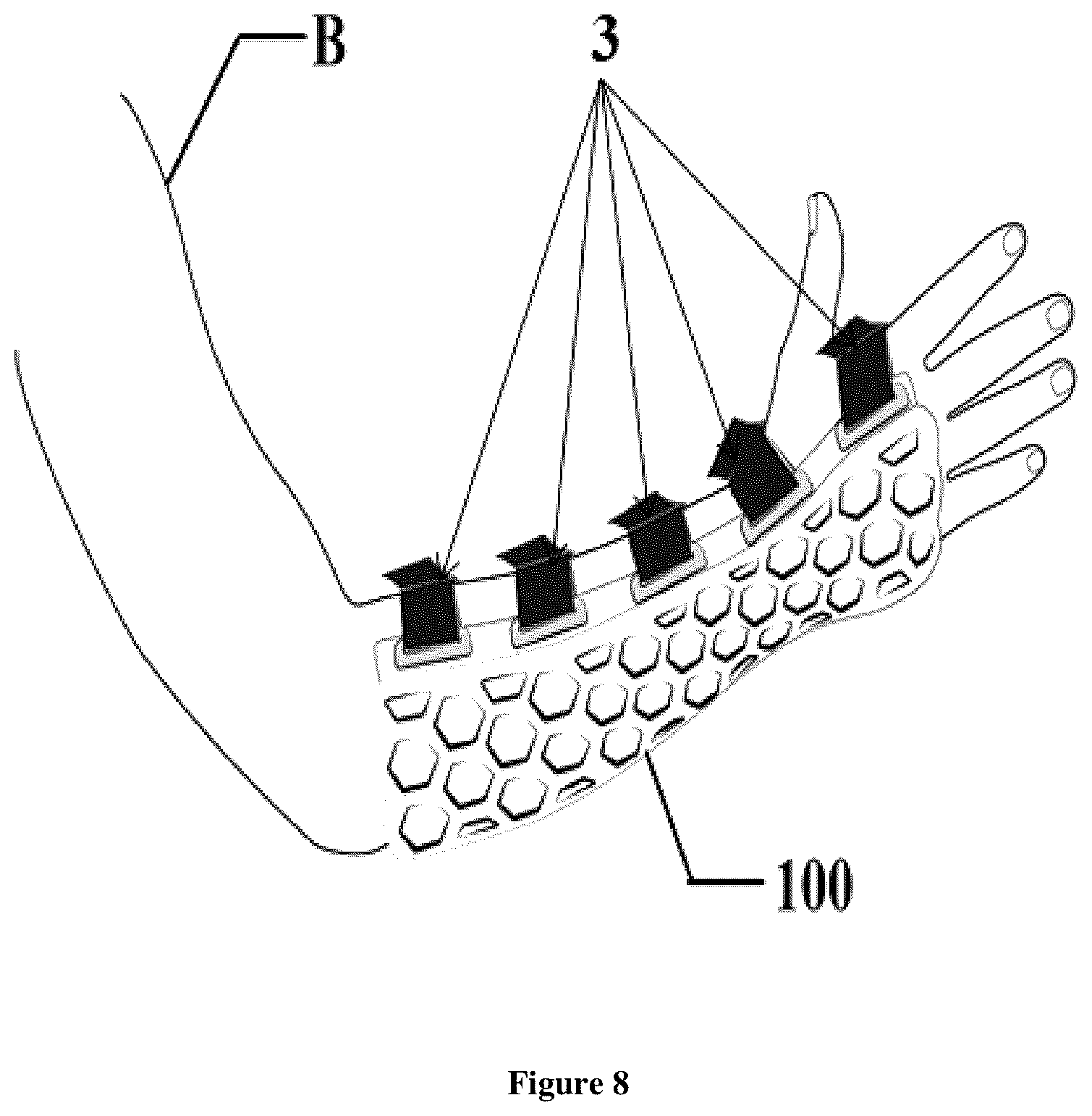 Patent US12376997 Figure 8 – Adjustable limb stabilization device