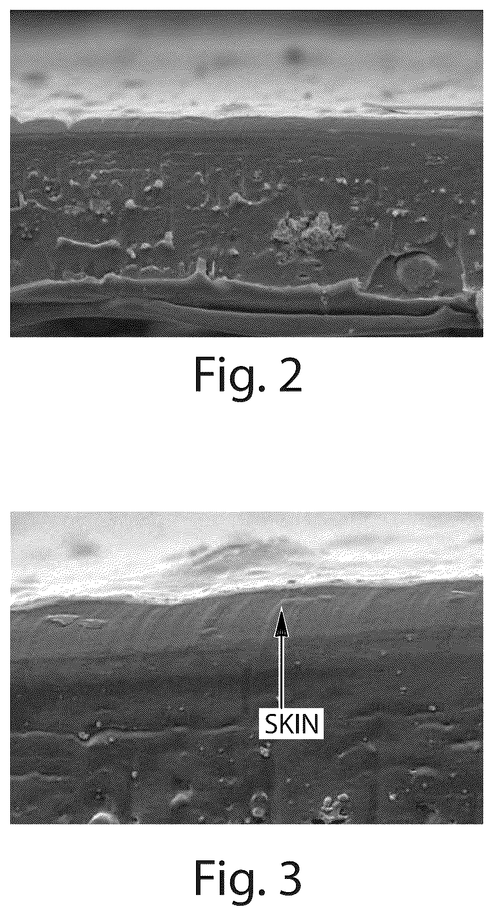 Patent US12377000 Figure 2 – Absorbent articles comprising stretch laminates