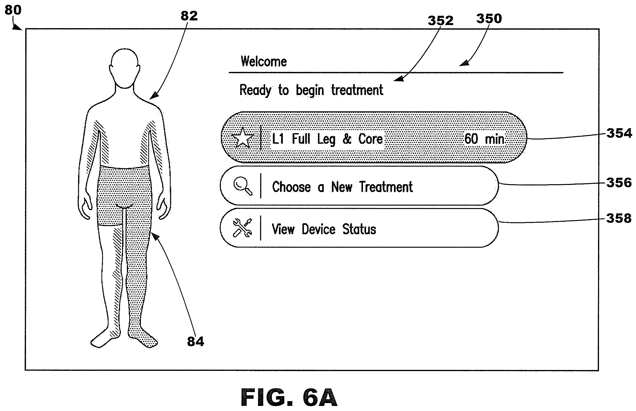 Patent US12377013 Figure 6 – Compression garment systems