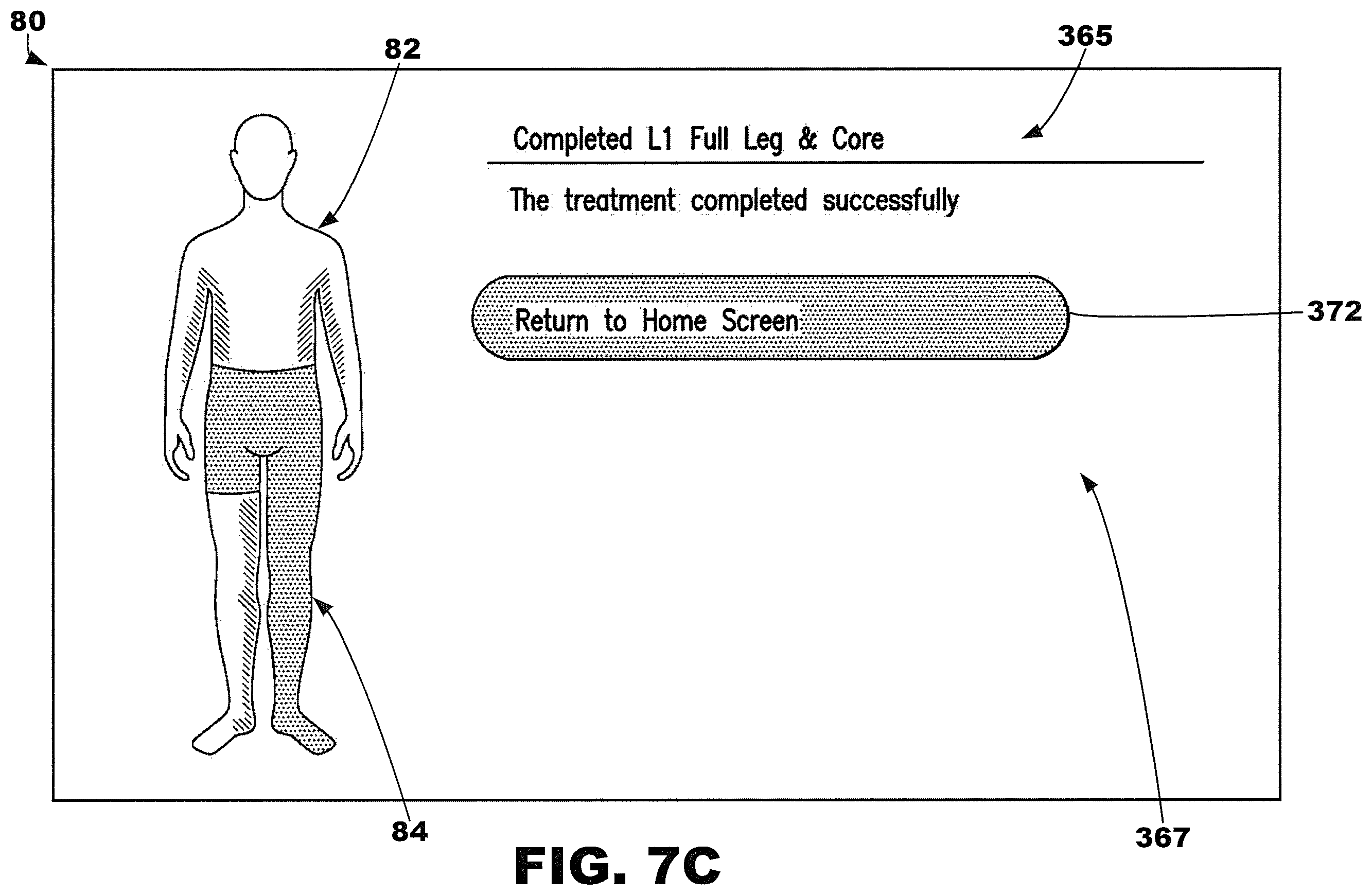 Patent US12377013 Figure 11 – Compression garment systems
