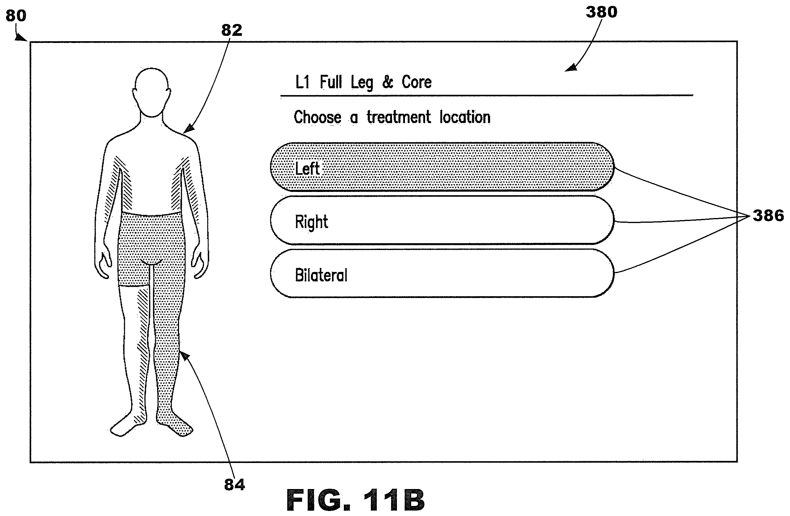 Patent US12377013 Figure 16 – Compression garment systems