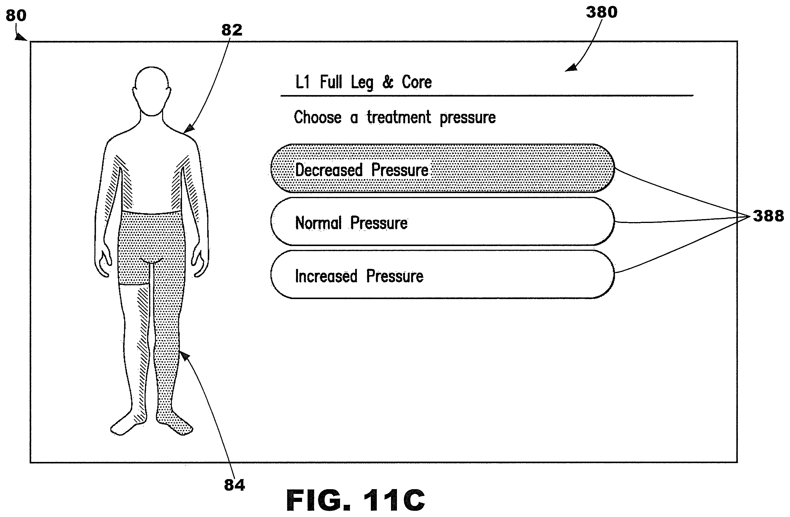 Patent US12377013 Figure 17 – Compression garment systems