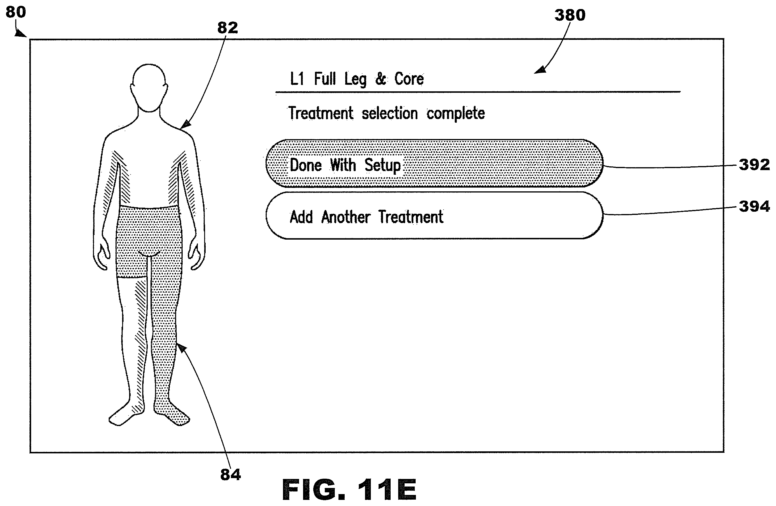 Patent US12377013 Figure 19 – Compression garment systems