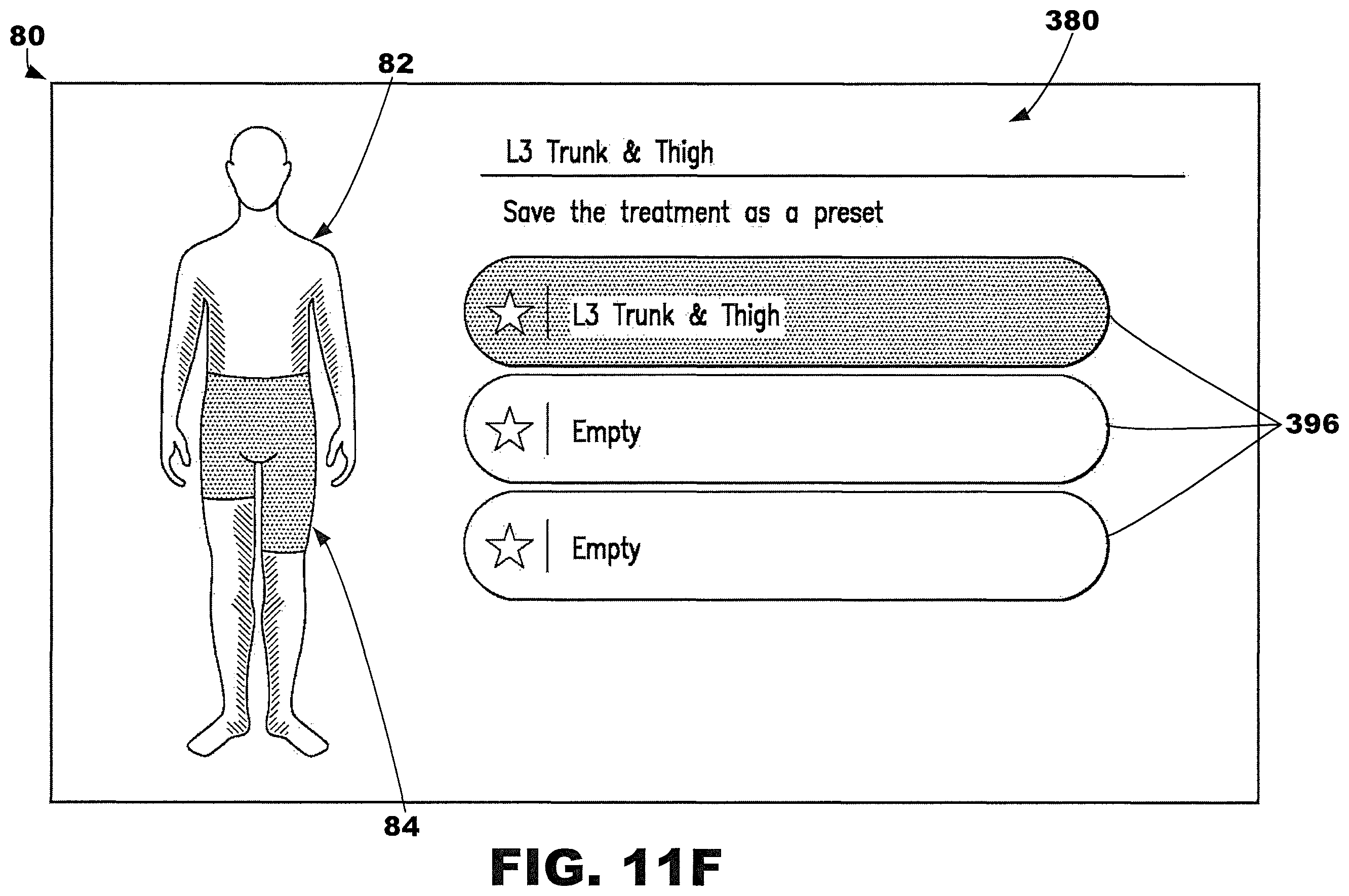 Patent US12377013 Figure 20 – Compression garment systems