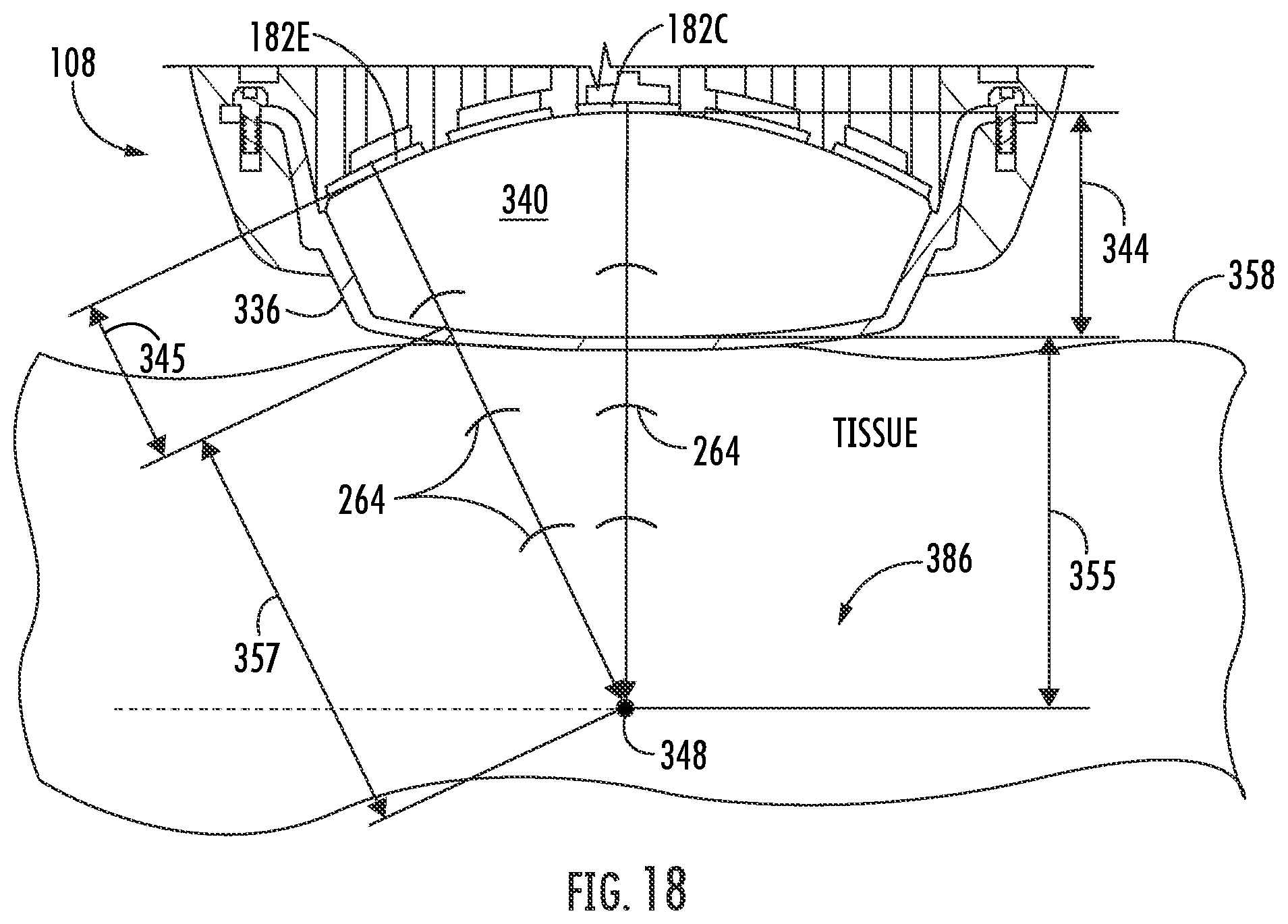 Patent US12377017 Figure 16 – Handheld focused extracorporeal shock wave therapy device, kit, and method