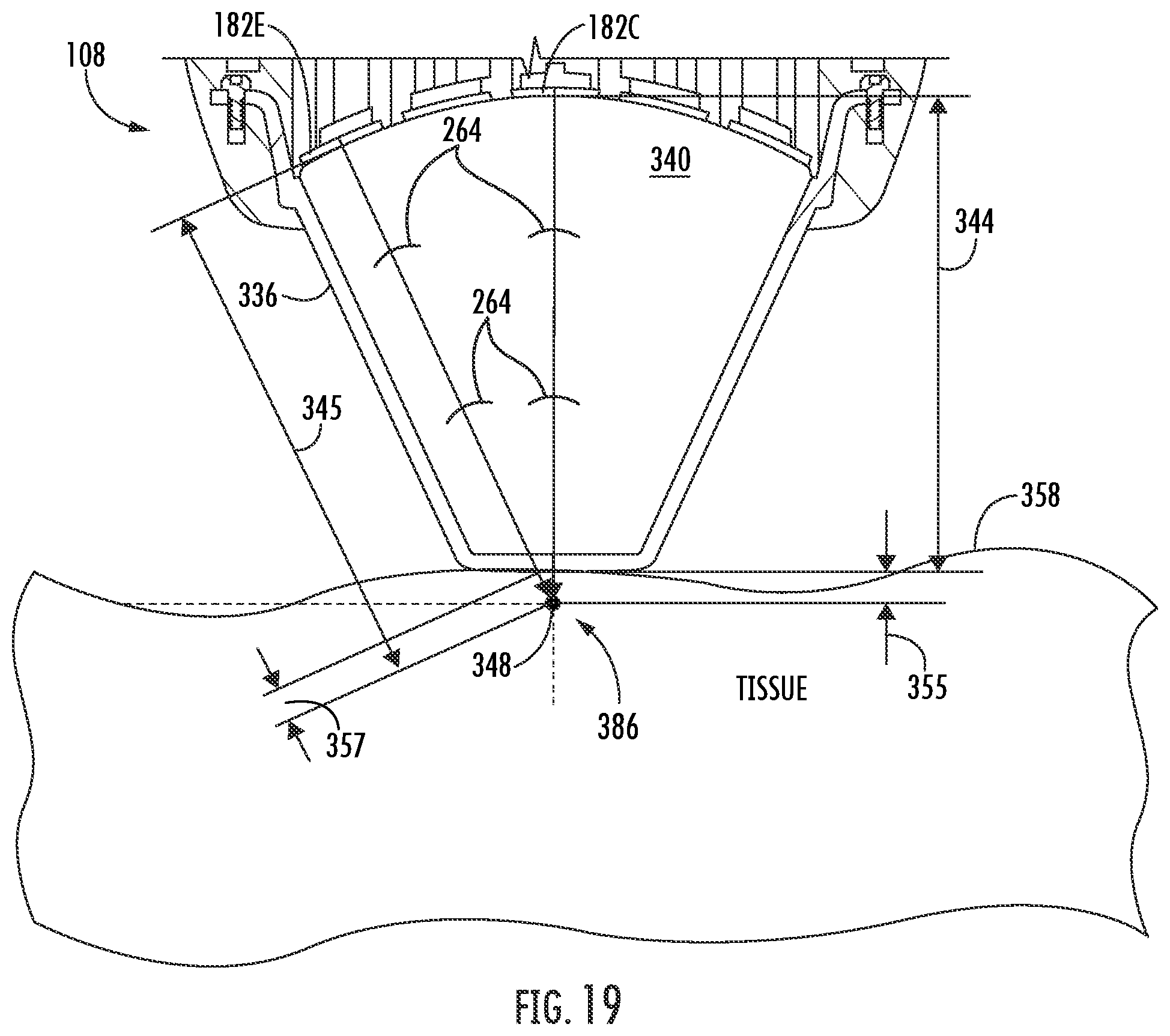 Patent US12377017 Figure 17 – Handheld focused extracorporeal shock wave therapy device, kit, and method