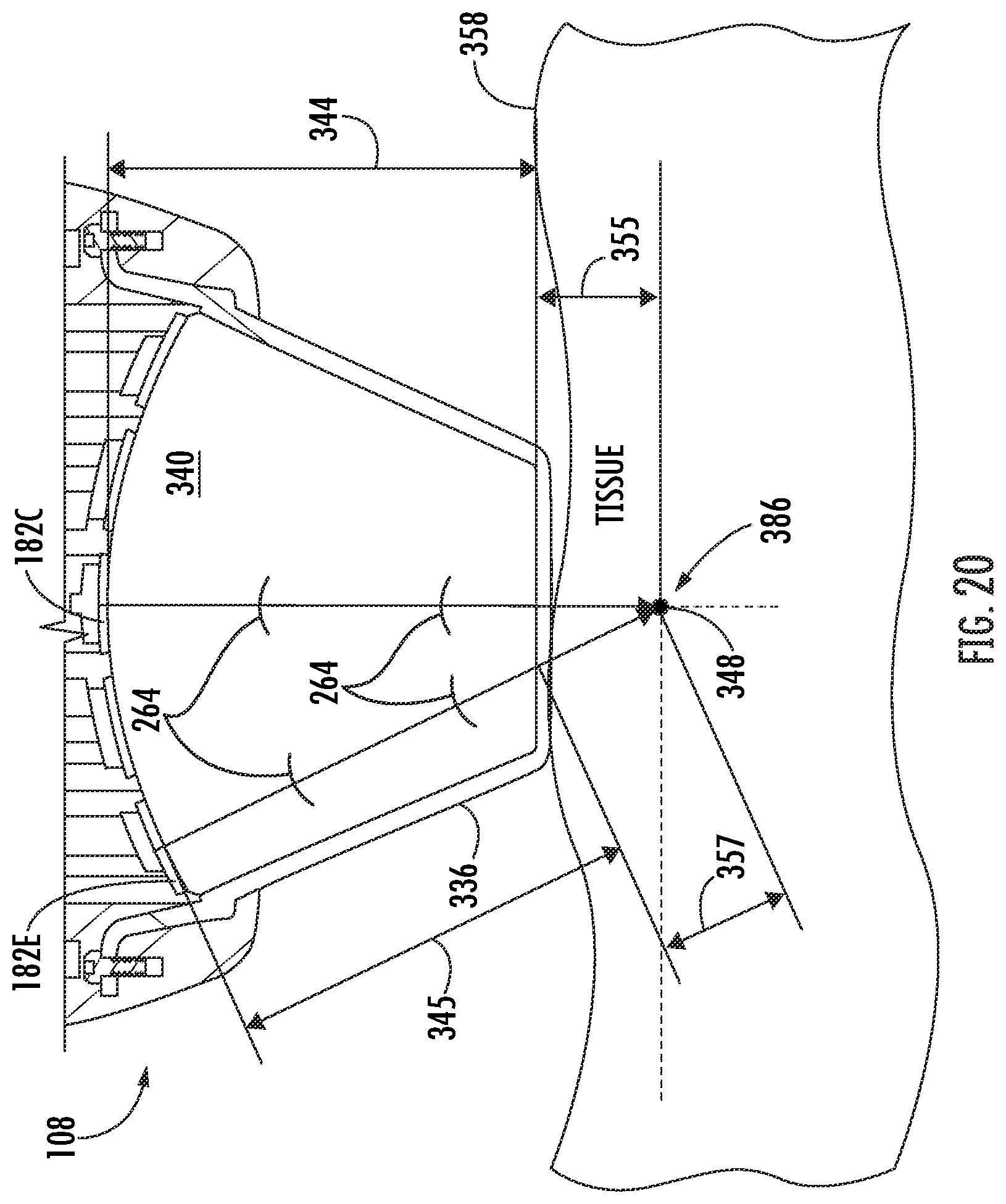 Patent US12377017 Figure 18 – Handheld focused extracorporeal shock wave therapy device, kit, and method