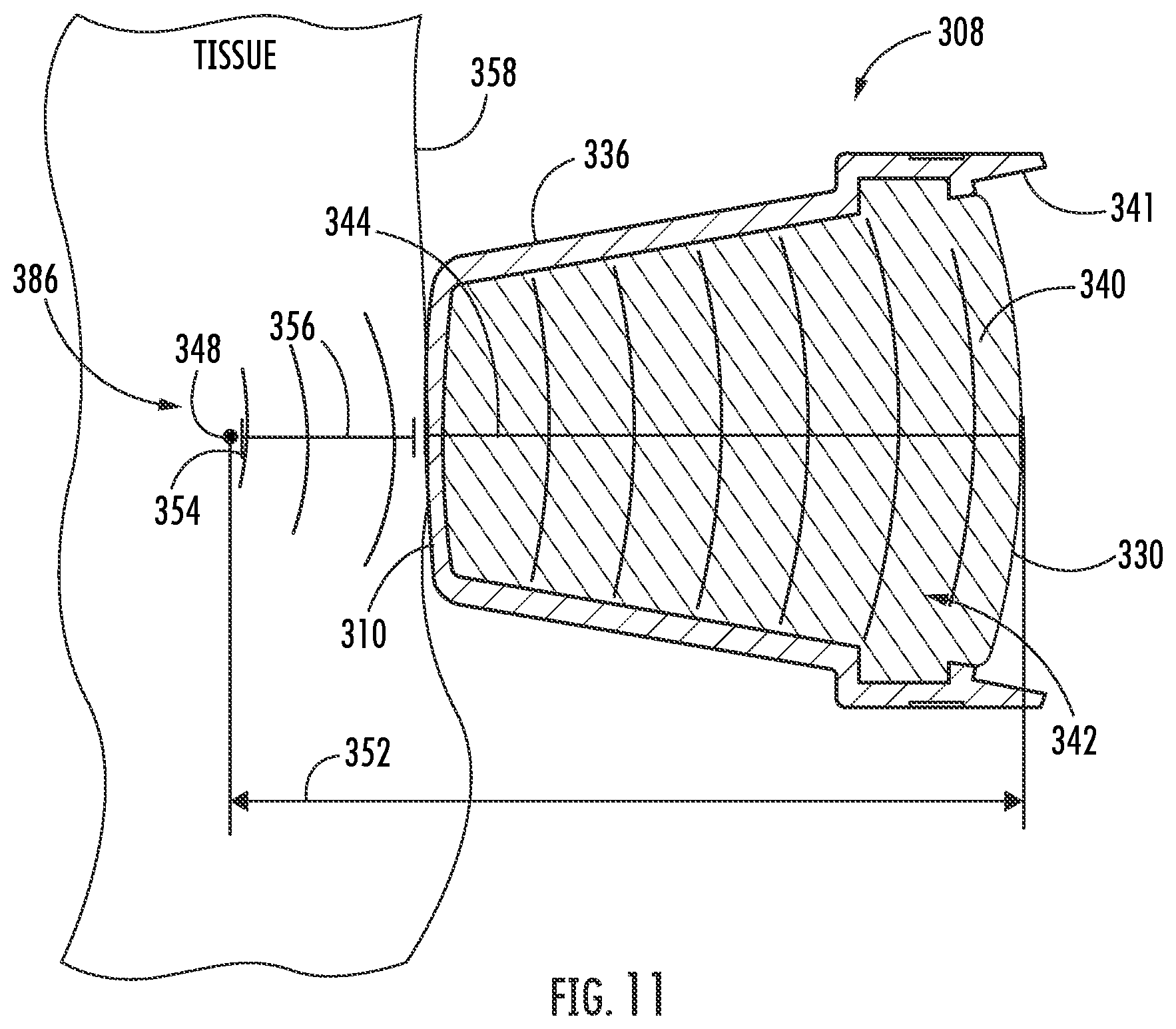 Patent US12377018 Figure 10 – Handheld focused extracorporeal shock wave therapy device, kit, and method