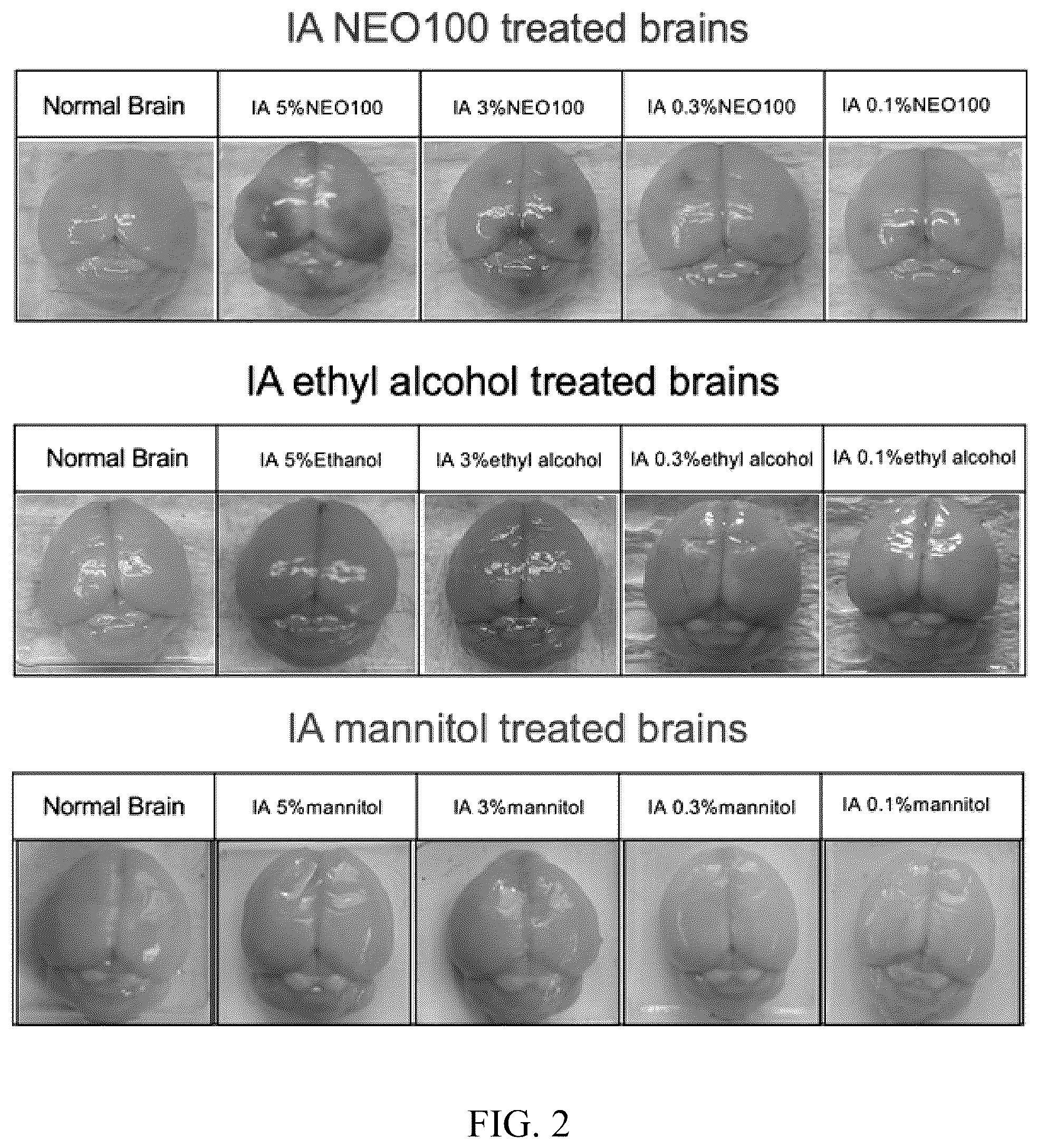 Patent US12377057 Figure 2 – Arterial application of low dose ethyl alcohol enables blood-brain barrier (BBB) transient opening