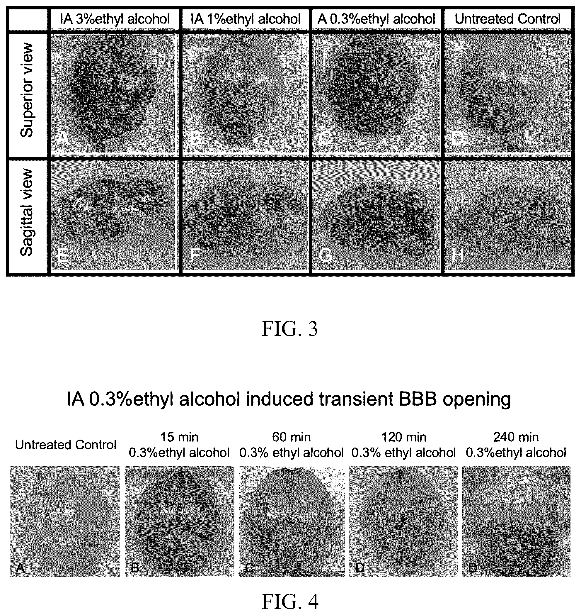 Patent US12377057 Figure 3 – Arterial application of low dose ethyl alcohol enables blood-brain barrier (BBB) transient opening