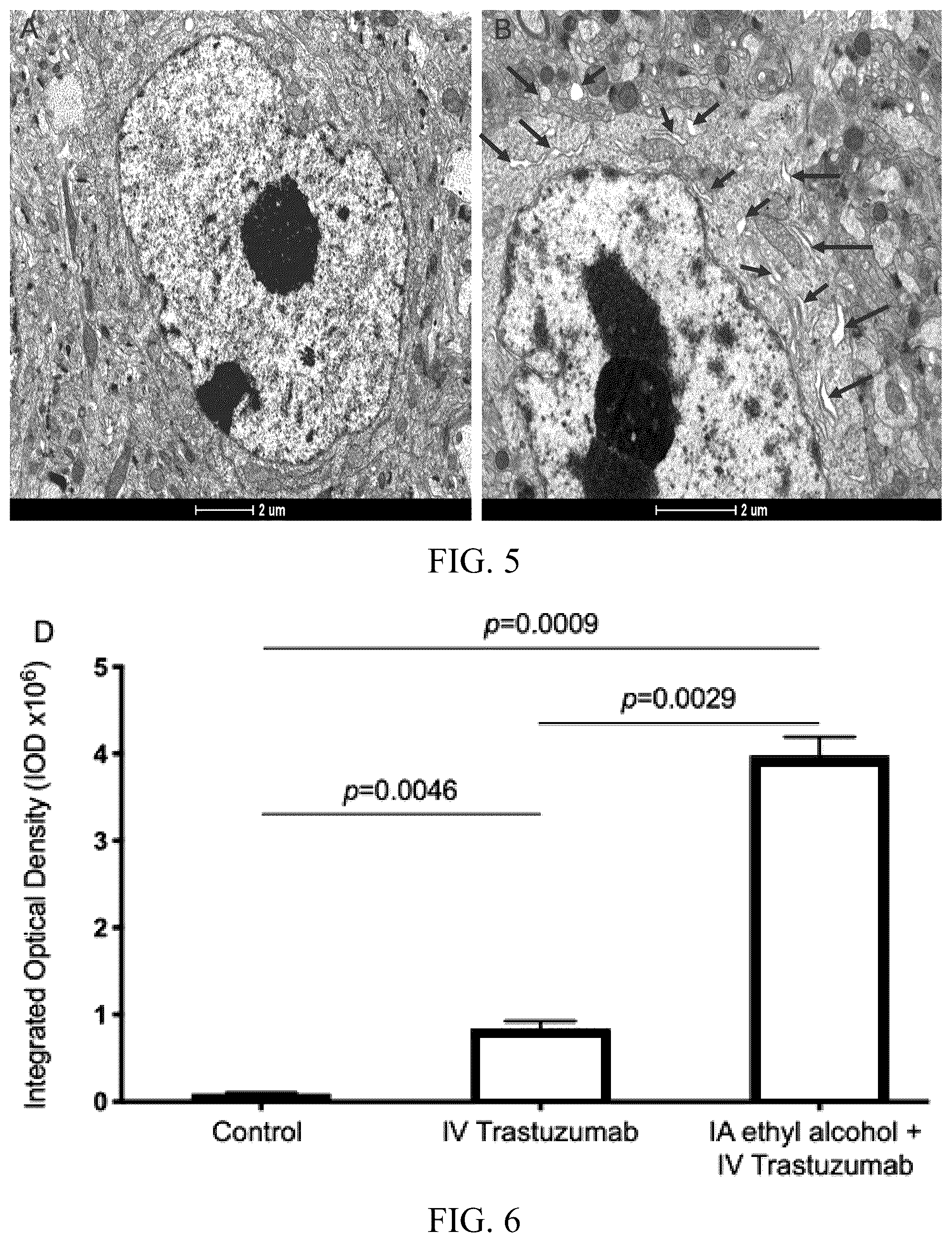 Patent US12377057 Figure 4 – Arterial application of low dose ethyl alcohol enables blood-brain barrier (BBB) transient opening
