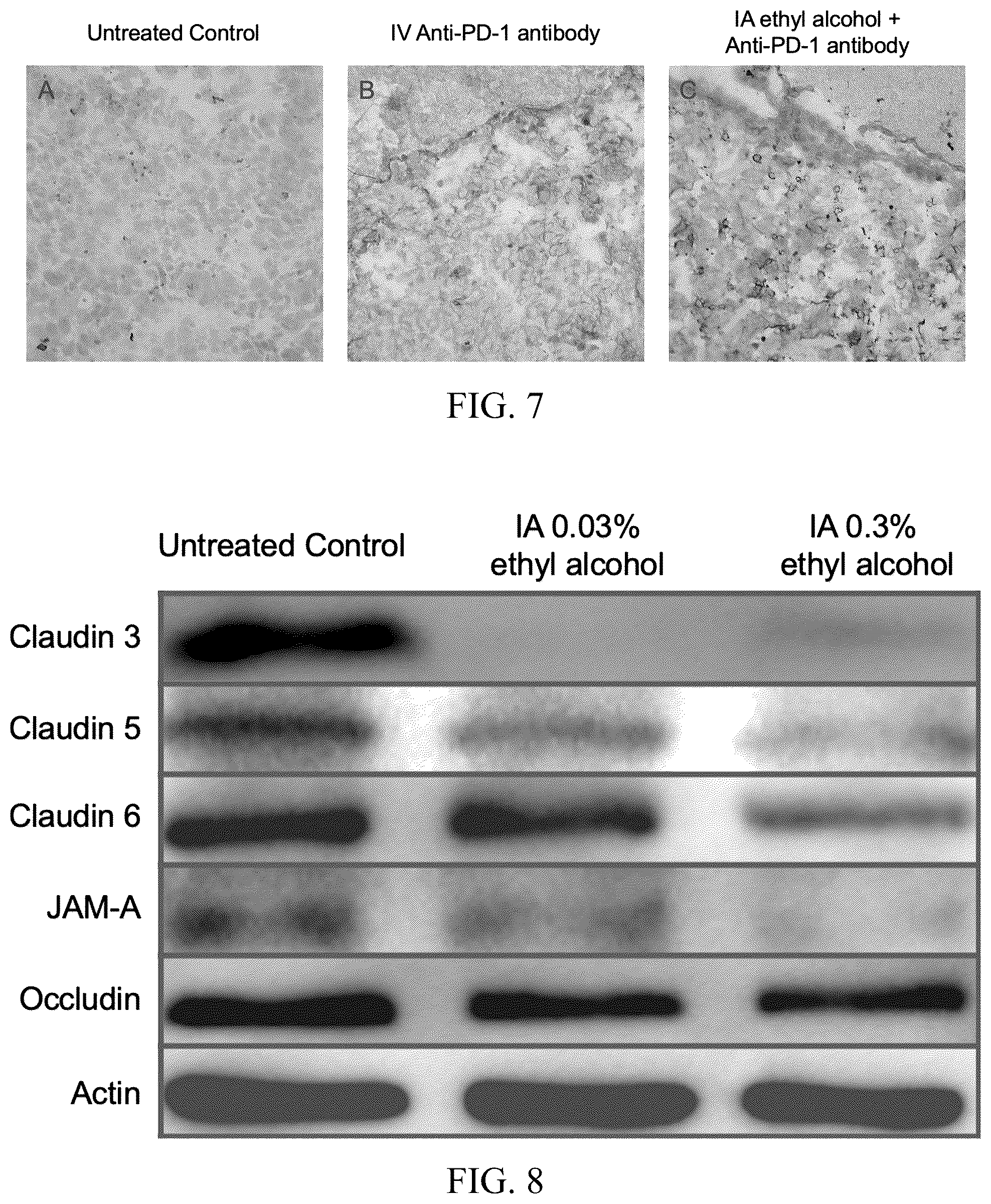 Patent US12377057 Figure 5 – Arterial application of low dose ethyl alcohol enables blood-brain barrier (BBB) transient opening
