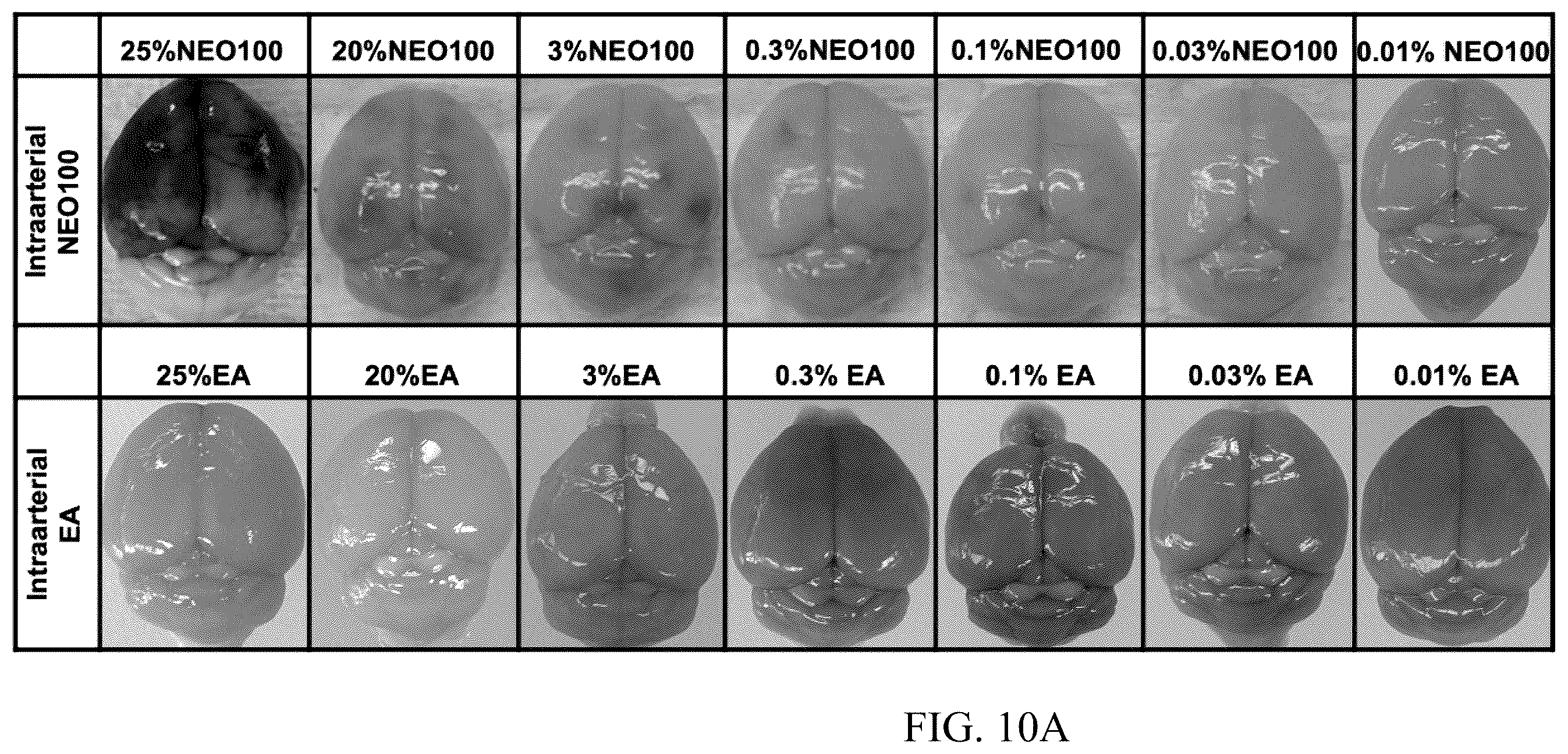 Patent US12377057 Figure 7 – Arterial application of low dose ethyl alcohol enables blood-brain barrier (BBB) transient opening