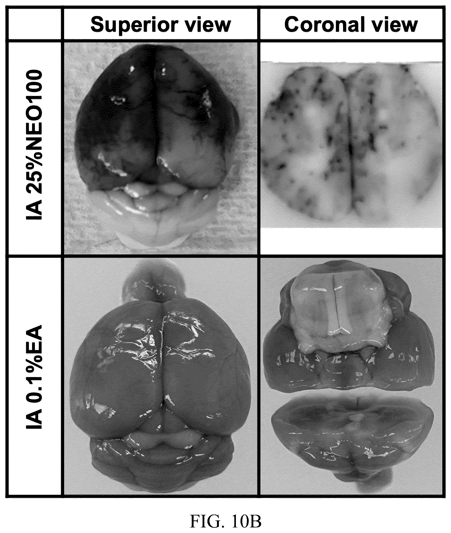 Patent US12377057 Figure 8 – Arterial application of low dose ethyl alcohol enables blood-brain barrier (BBB) transient opening