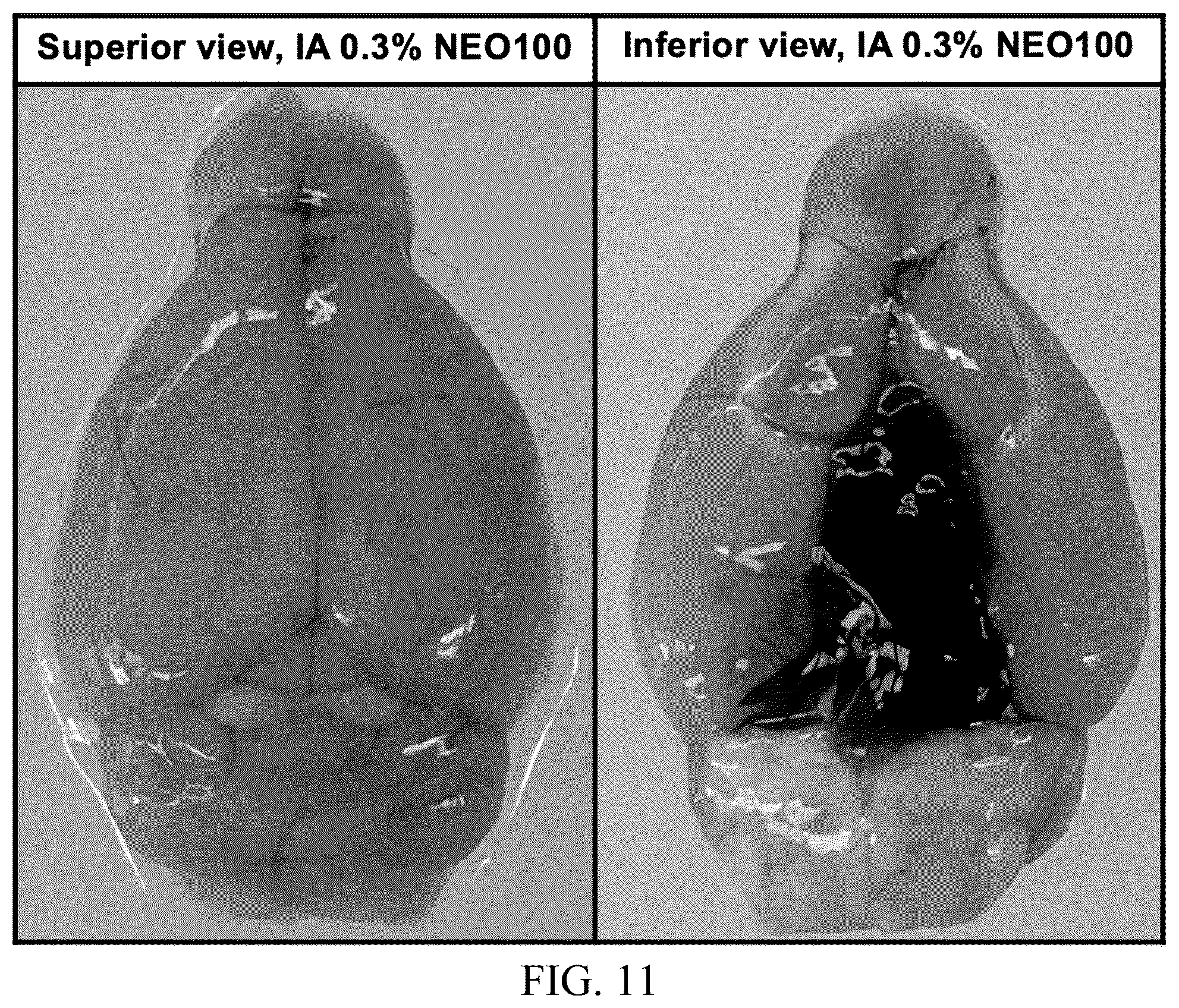 Patent US12377057 Figure 9 – Arterial application of low dose ethyl alcohol enables blood-brain barrier (BBB) transient opening